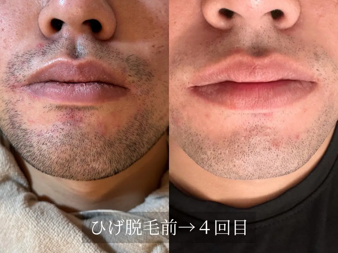 脱毛サロン Arumのエステ・リラクイメージ