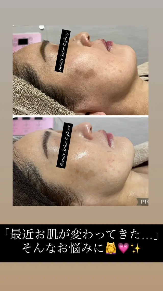 エステ ビューティーサロン B.glossyのネイルデザイン