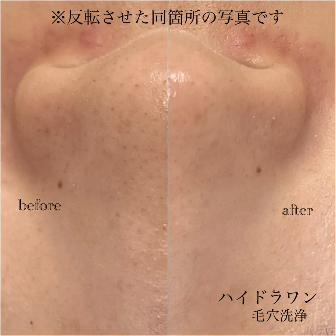マツエク・マツパ omii salon 草津店:yurinaのマツエク・マツパデザイン