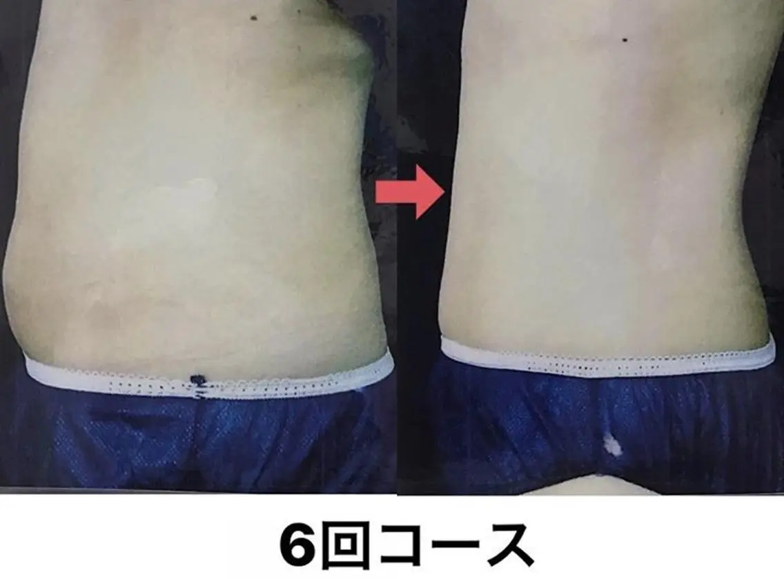 横浜エステサロン R-ing リングのエステ・リラクイメージ