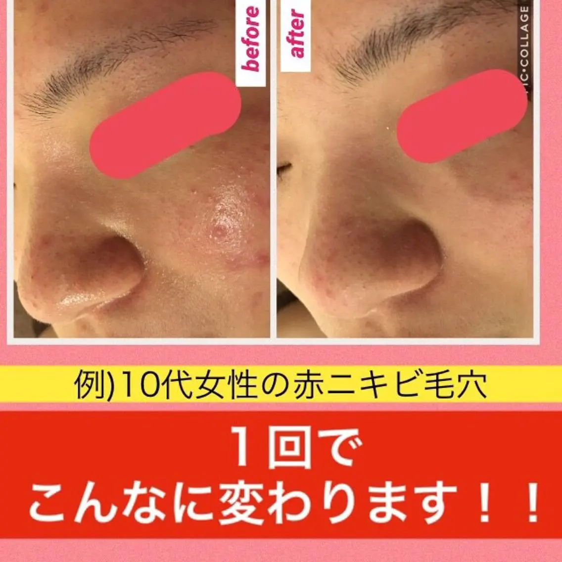 ショート カラー パーマ ヘアアレンジ メンズ キッズ ネイル マツエク・マツパ ニキビ・肌質改善専門 ♡人生が変わるサロンのエステ・リラクイメージ