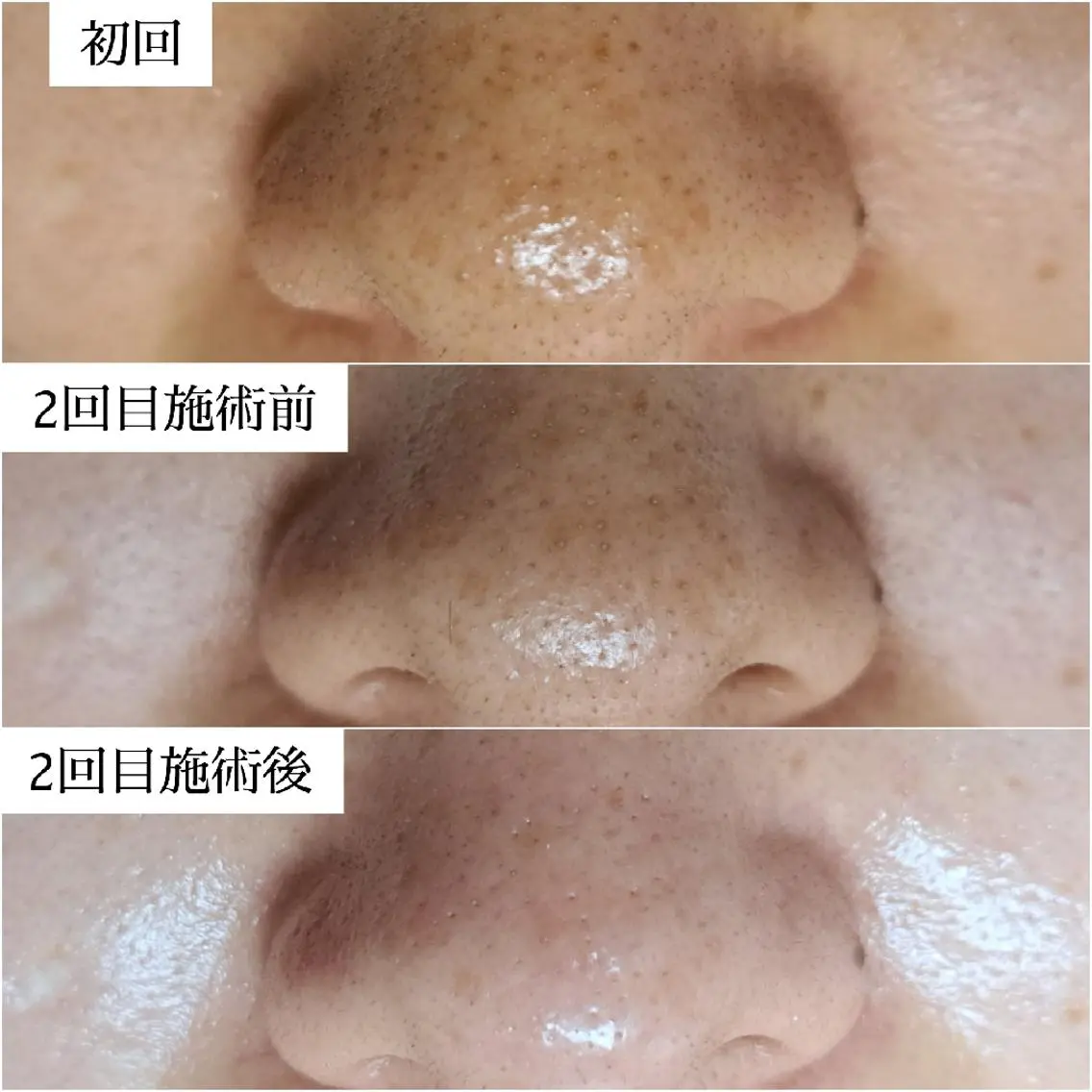 エステサロン LYSH愛名のエステ・リラクイメージ