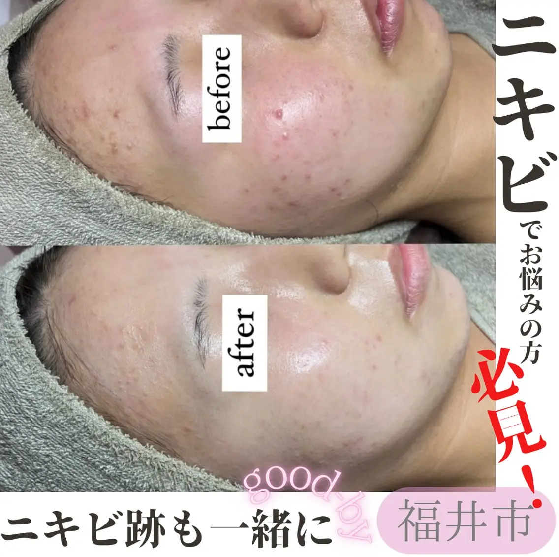 beauty salonWのエステ・リラクイメージ