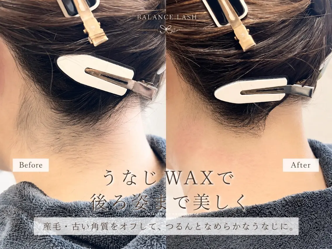 脱毛 Balance facialのエステ・リラクイメージ