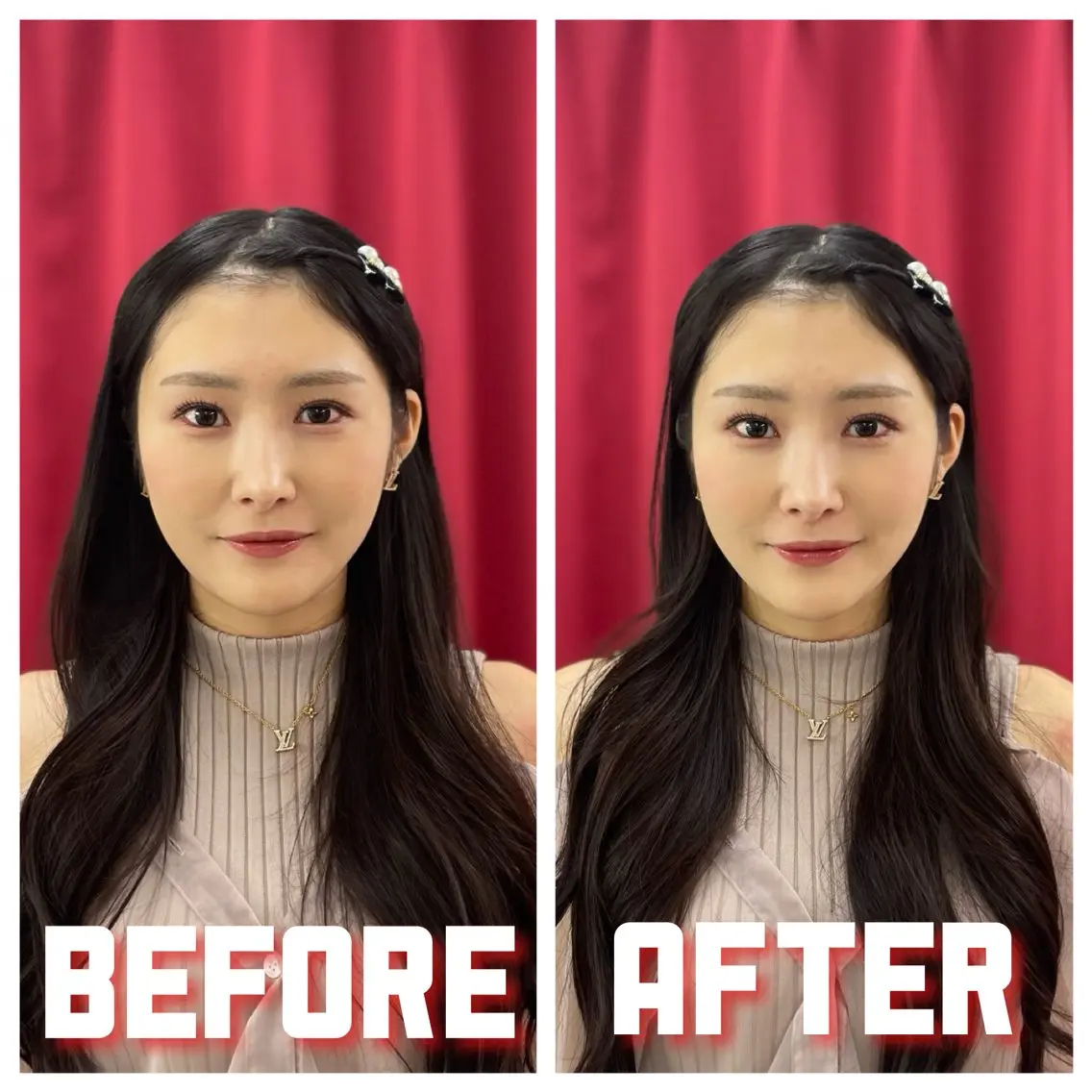 美容鍼 IKEZAKIのエステ・リラクイメージ