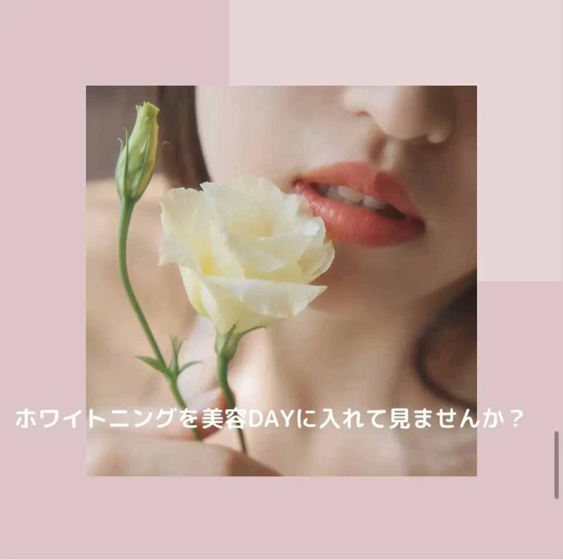 ホワイトニング ショップ伊丹店のその他イメージ