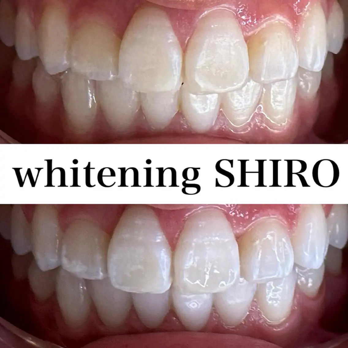 福岡ホワイトニング SHIRO天神店のエステ・リラクイメージ