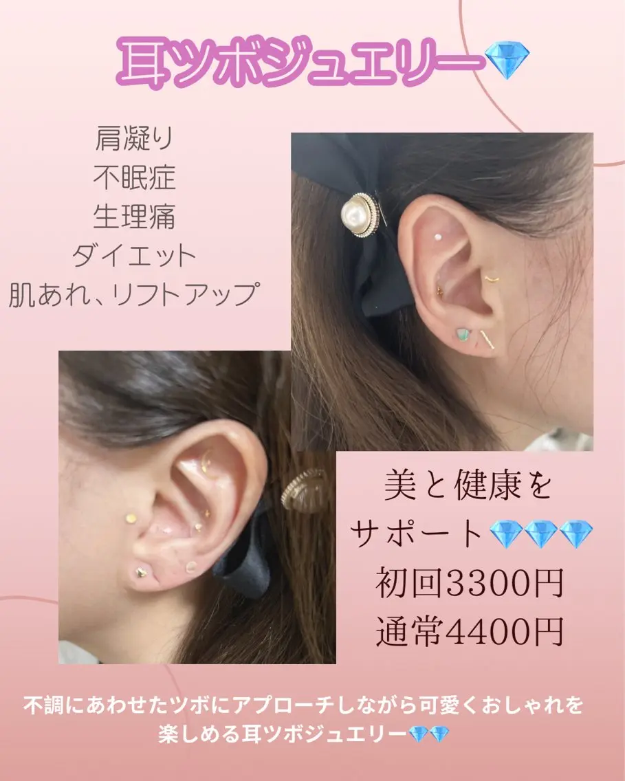 話題の耳ツボジュエリー💎の写真
