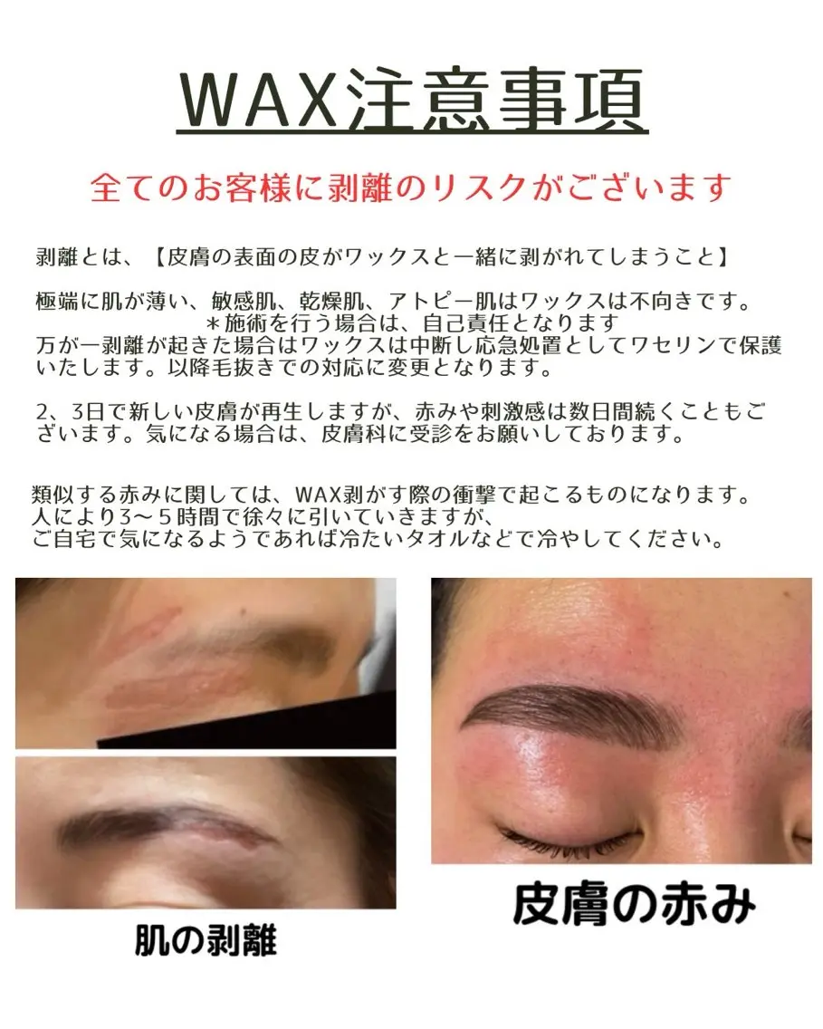 🩵✨⚪︎月⚪︎日限定✨🩵ワックス&間引き🫧の写真