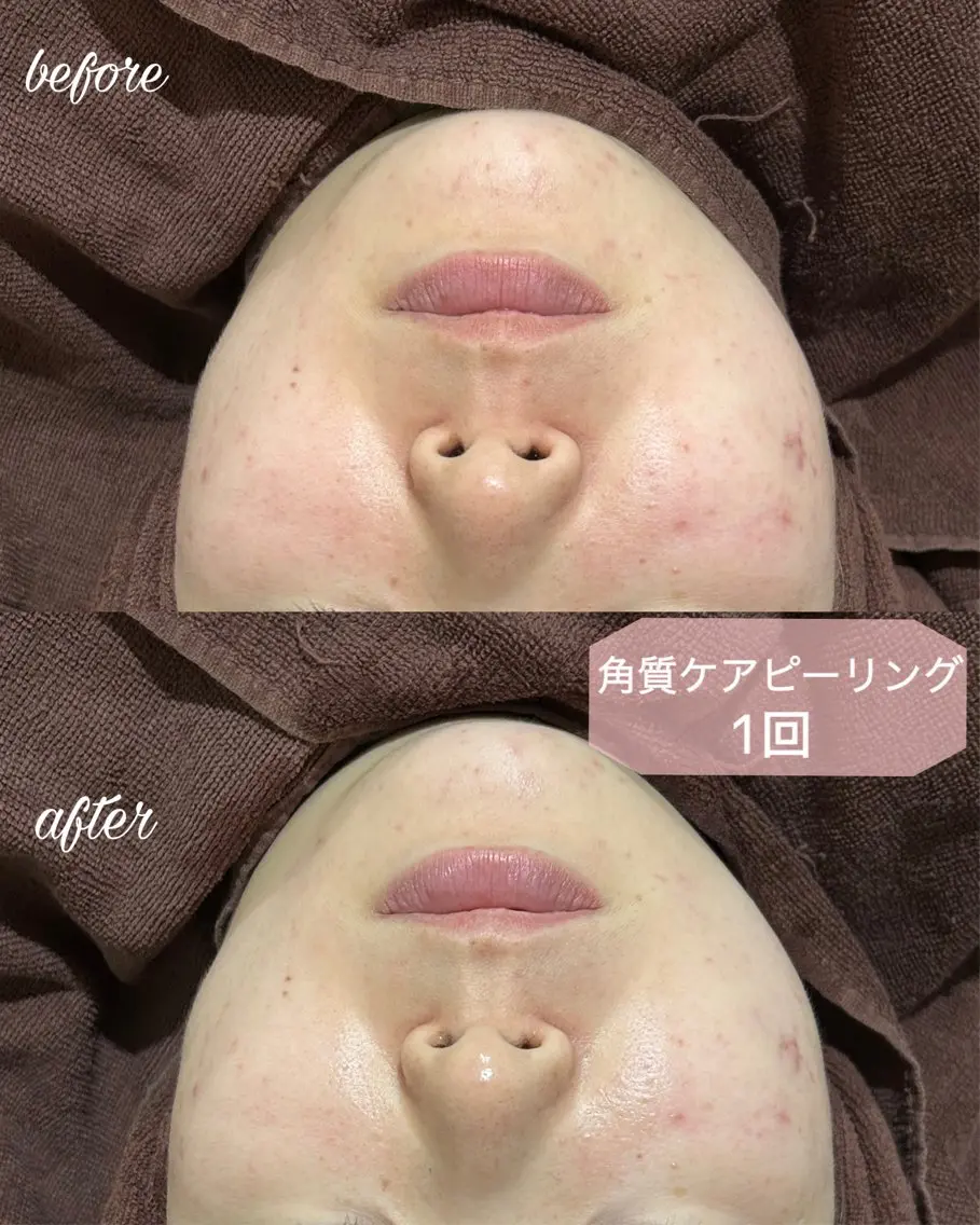 マツエク・マツパ アイリッドアップパーマ マツパ まつげ/整体/にきび ・アトピー専門サロンのマツエク・マツパデザイン