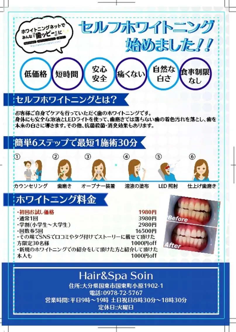 セルフホワイトニング5回、回数券の写真