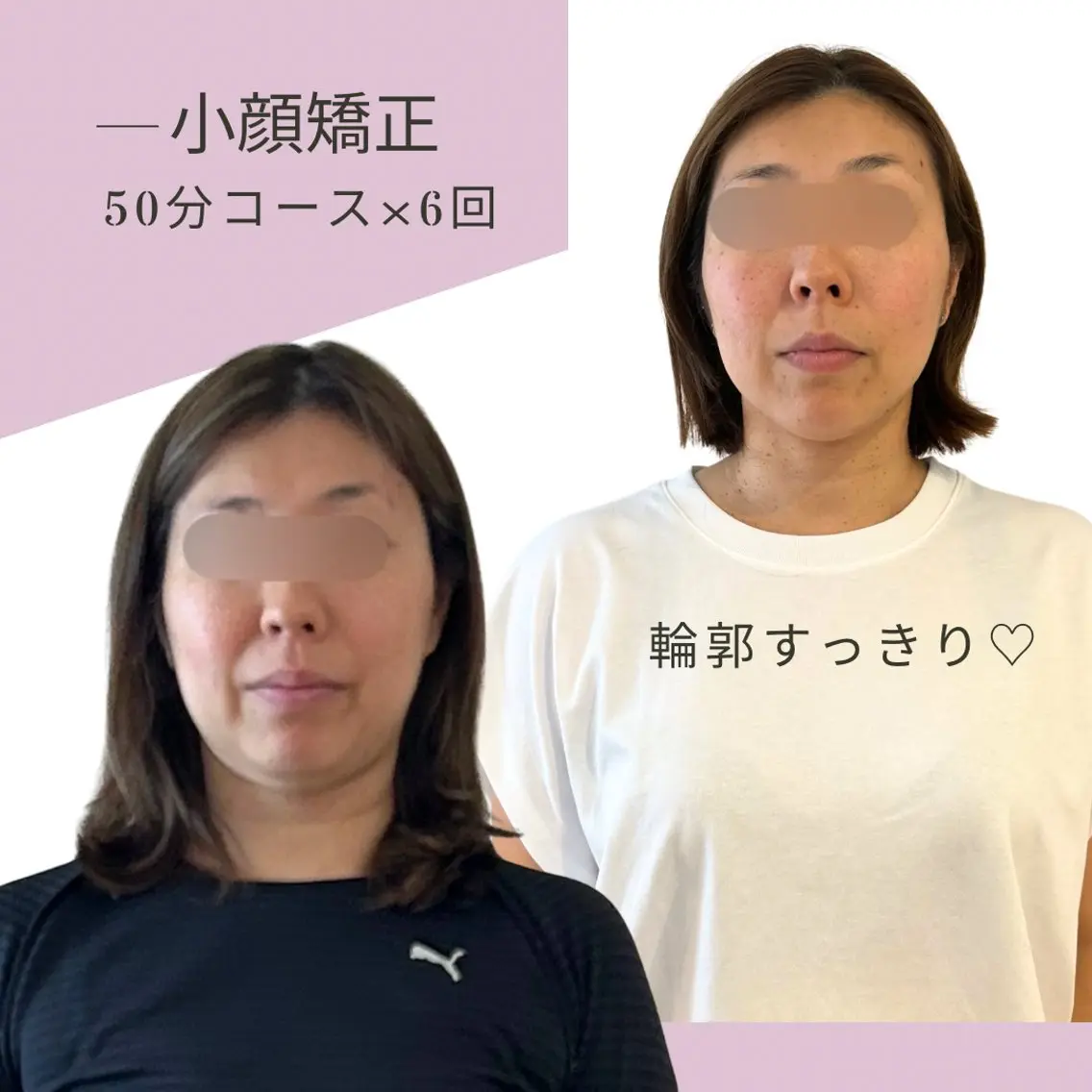エステ リラク 小顔美人になる 専門サロンLUCYのエステ・リラクイメージ