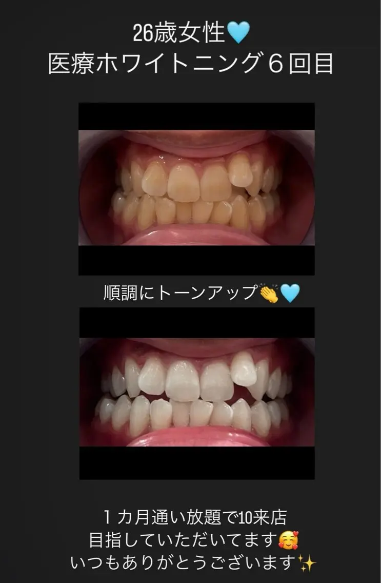 Kaula ホワイトニング🦷✨のエステ・リラクイメージ