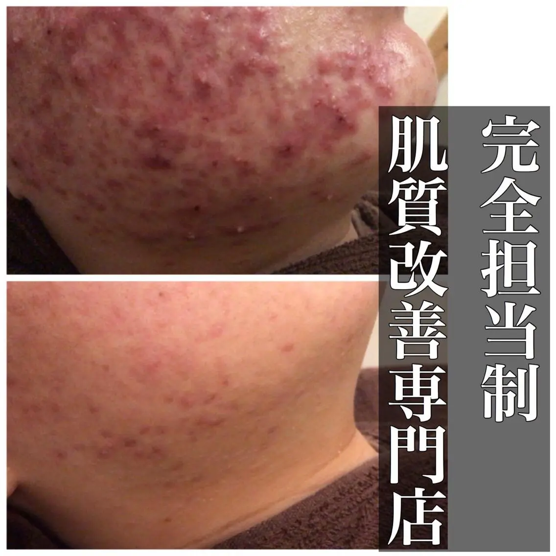 ミディアム カラー パーマ ヘアアレンジ メンズ キッズ ネイル マツエク・マツパ エステ リラク ニキビ・肌質改善専門 ♡人生が変わるサロンのエステ・リラクイメージ