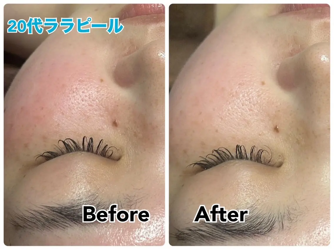 エステ 【毛穴・美白・美肌】 美・up 青葉台店のエステ・リラクイメージ
