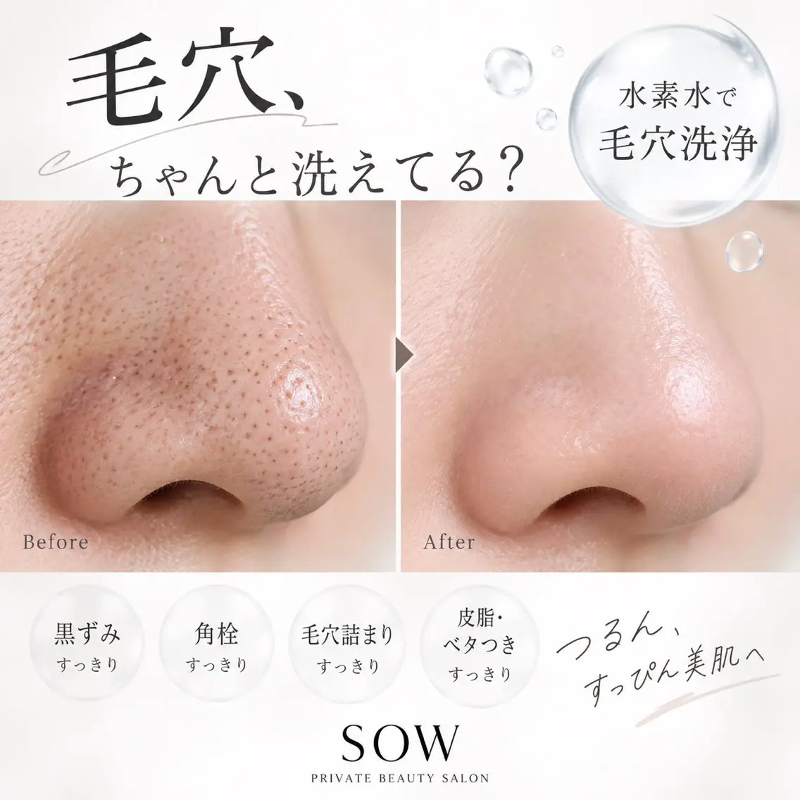 【エステデビュー応援📣】水素水で毛穴洗浄✨黒ずみ・角栓すっきり毛穴ケアの写真