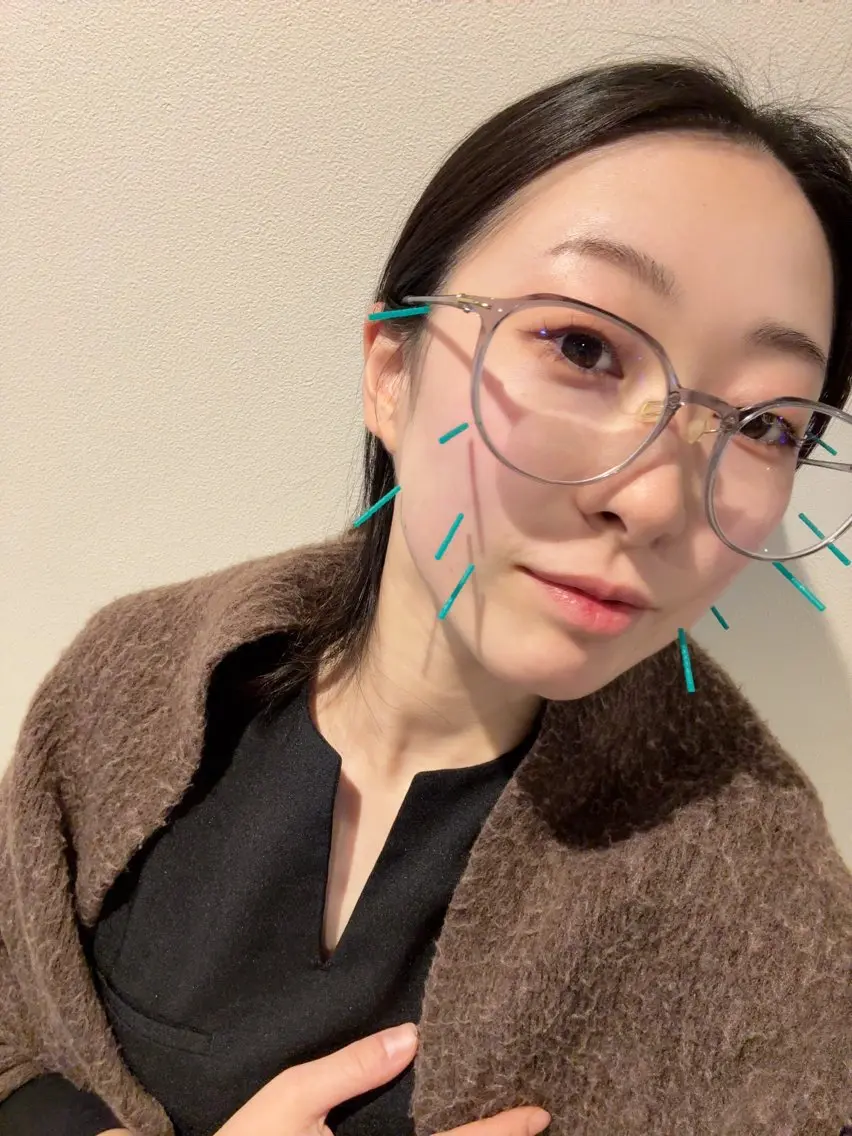 鍼灸師🌿 染谷彩和のエステ・リラクイメージ