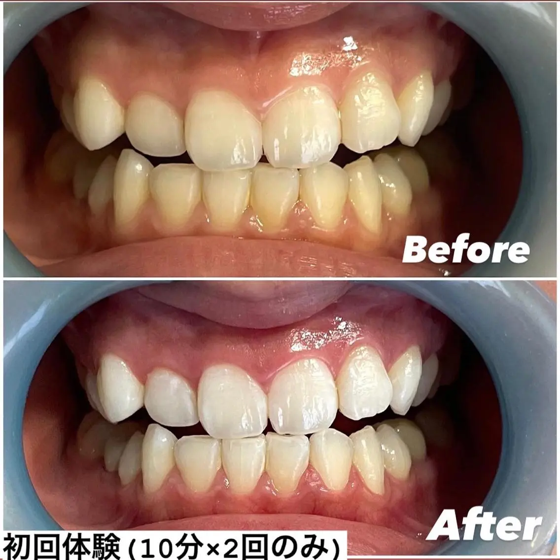 その他 ホワイトニング専門店 Hi-Whiteのその他イメージ