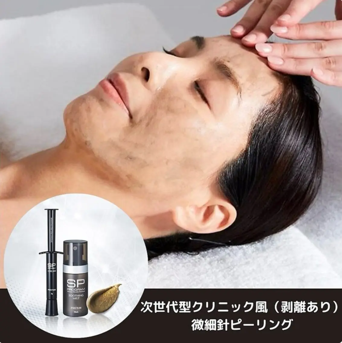 💎【剥離あり◎究極肌質改善ピーリング】短期集中ケア💎～微細針×美容成分でつるんと新しい素肌へ✨～の写真