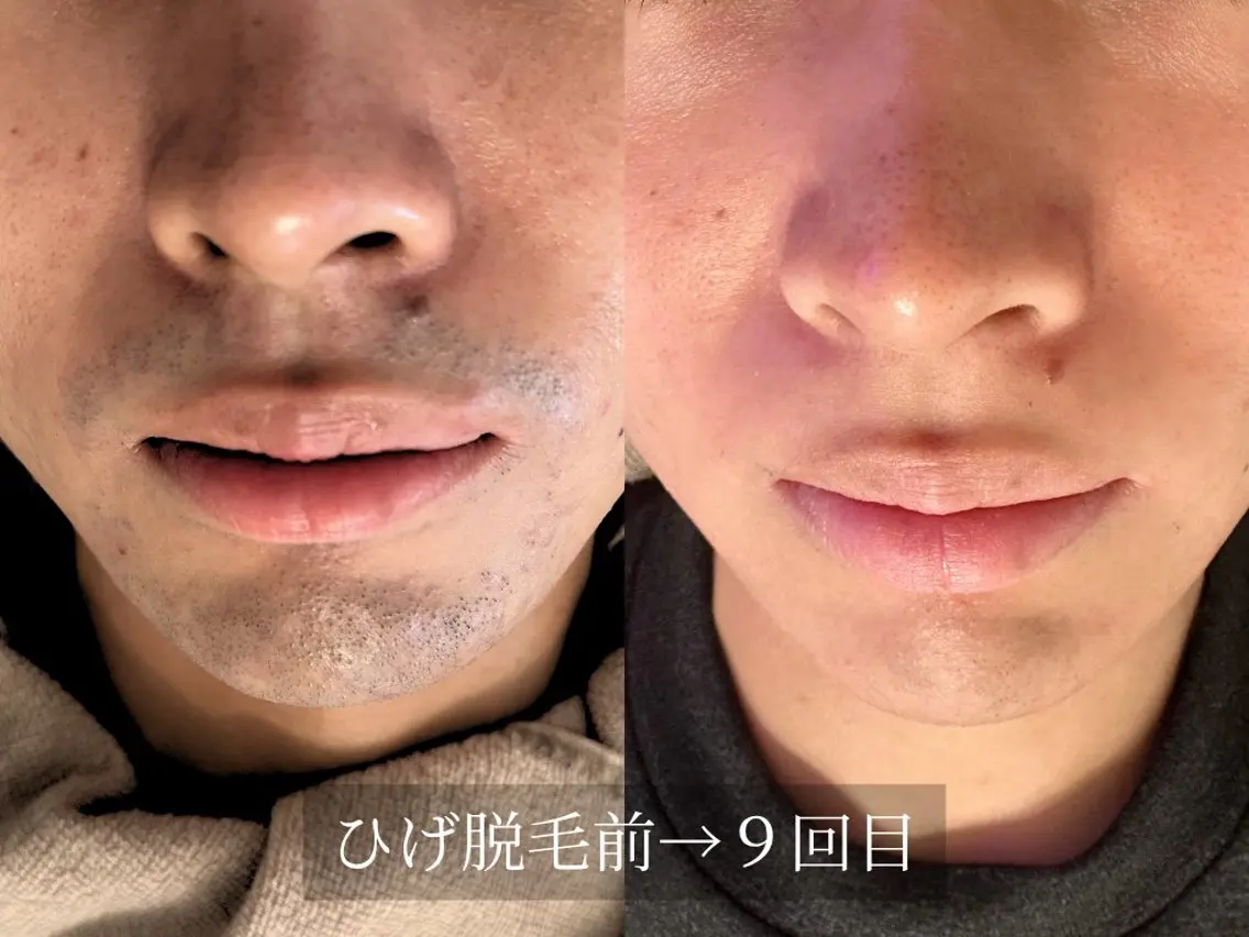 脱毛サロン Arumのエステ・リラクイメージ
