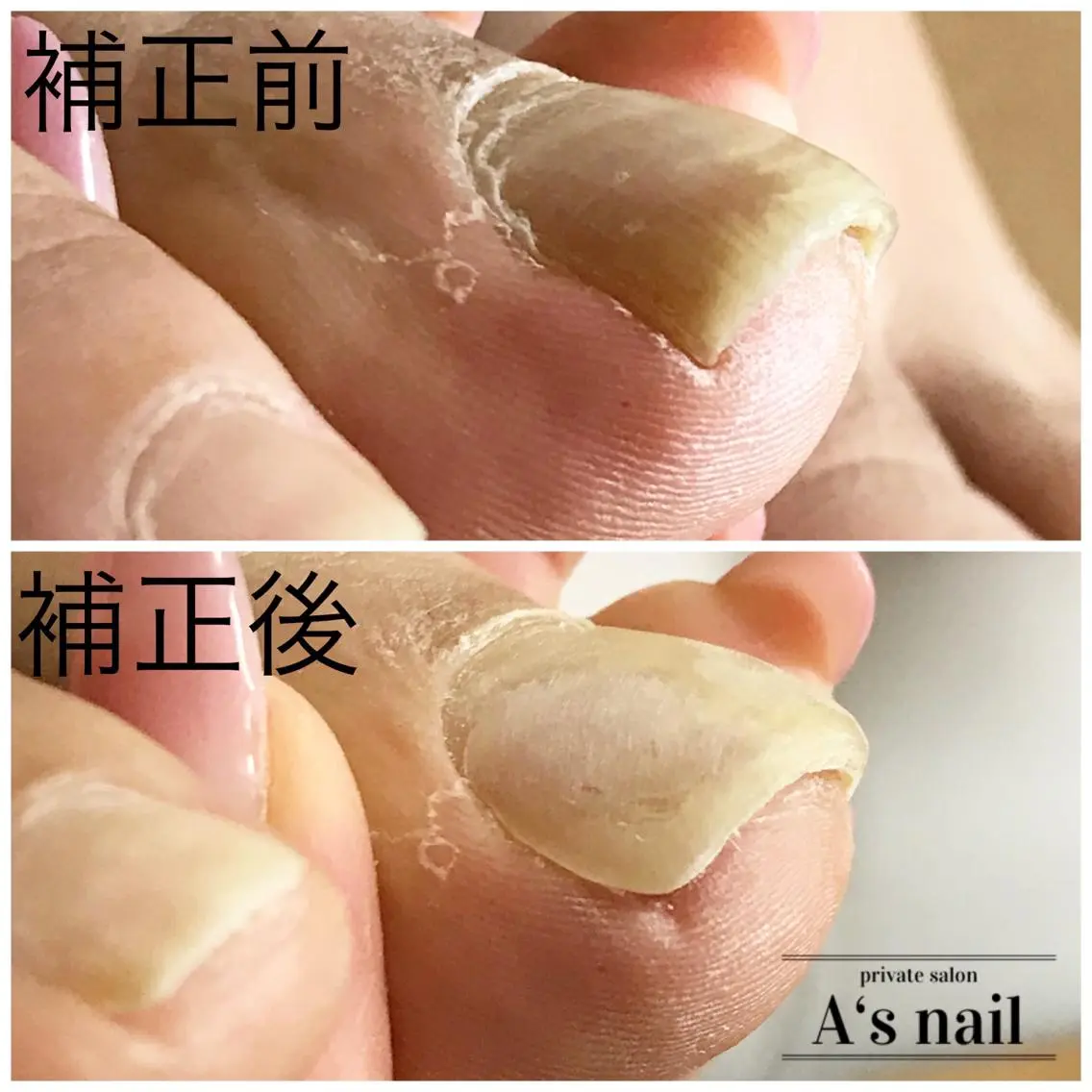 ネイル 比嘉 彩香のネイルデザイン