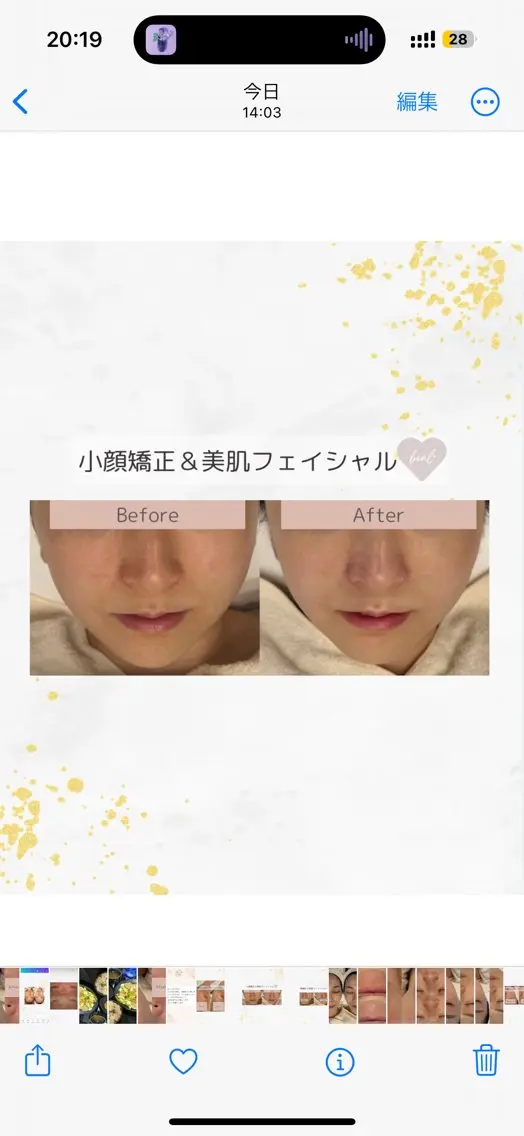 小顔/毛穴/ニキビ salon bealのエステ・リラクイメージ
