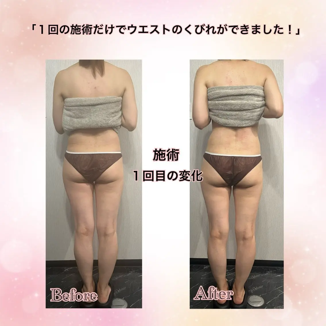 全身アロママッサージの写真