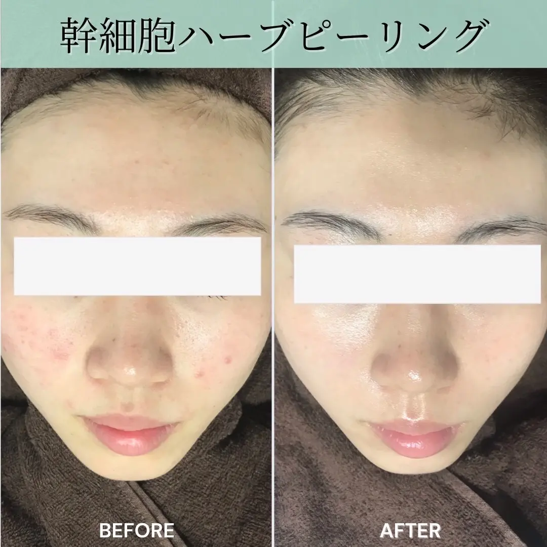 ヒト幹細胞サロン Melo Salon　新越谷店の内観・外観2