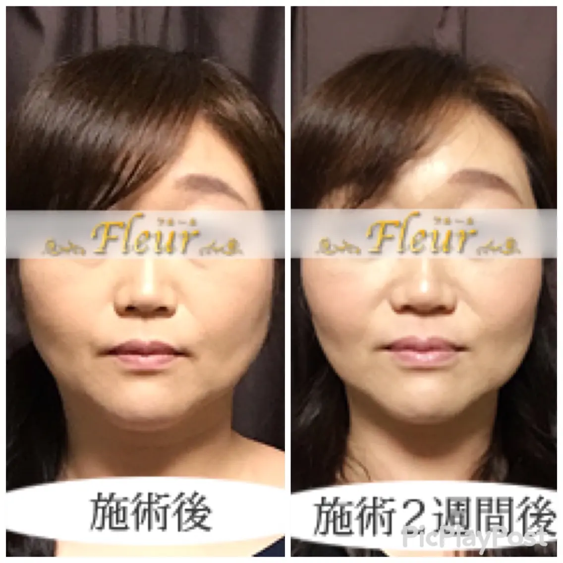 Faceline fleurの内観・外観3