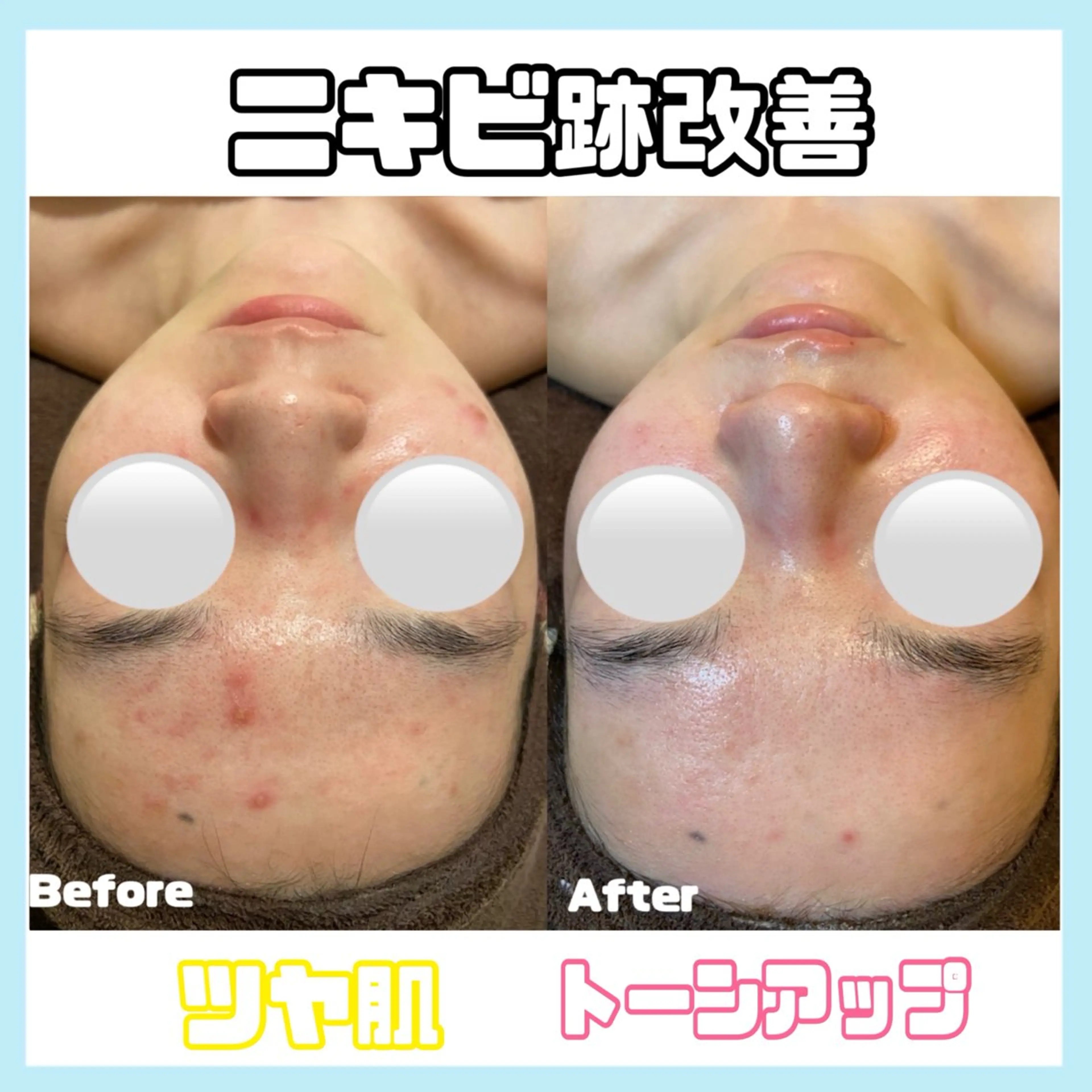 エステ オールハンド専門🤍 痩身/小顔/ ハーブのエステ・リラクイメージ