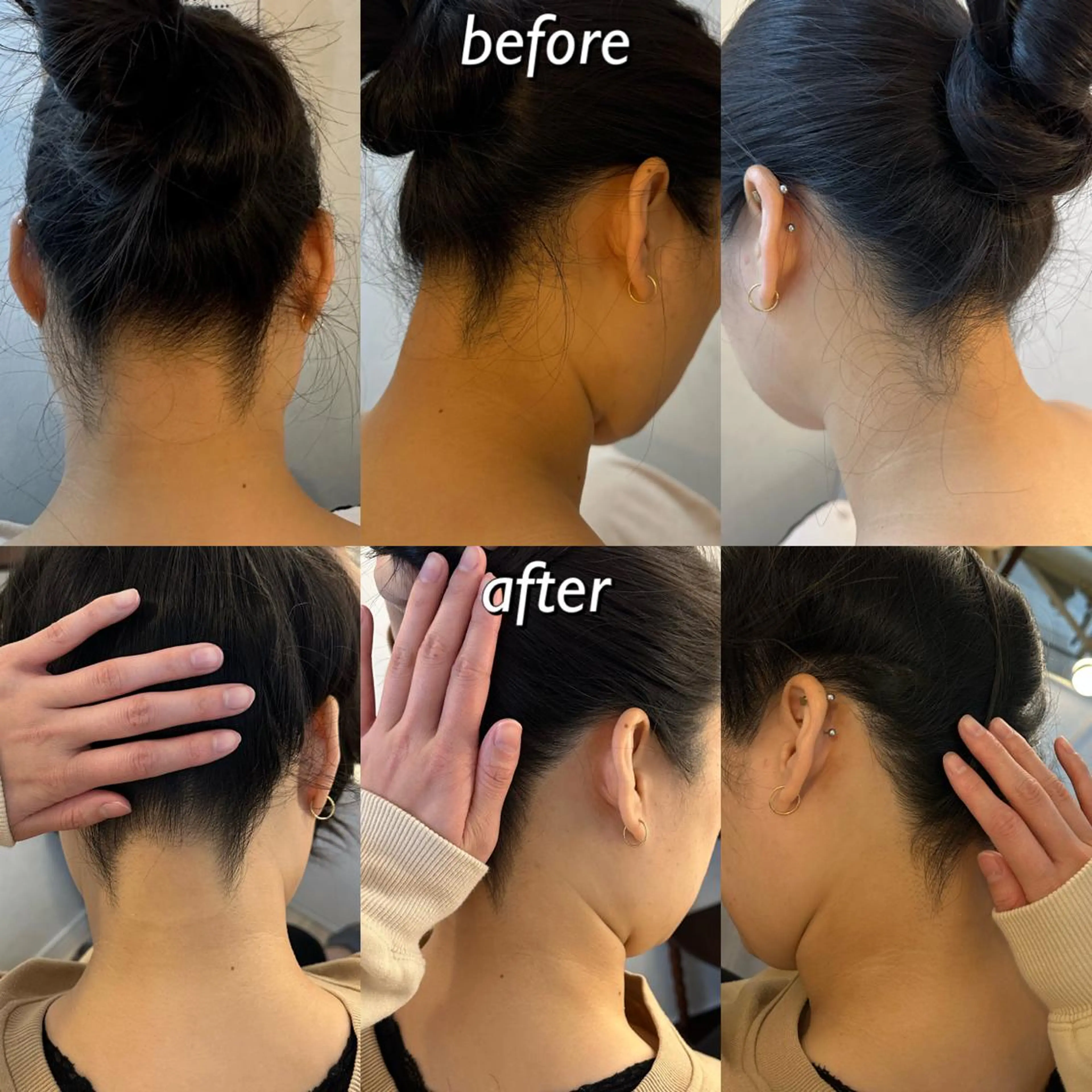 うなじ脱毛/美肌脱毛 LABELのエステ・リラクイメージ