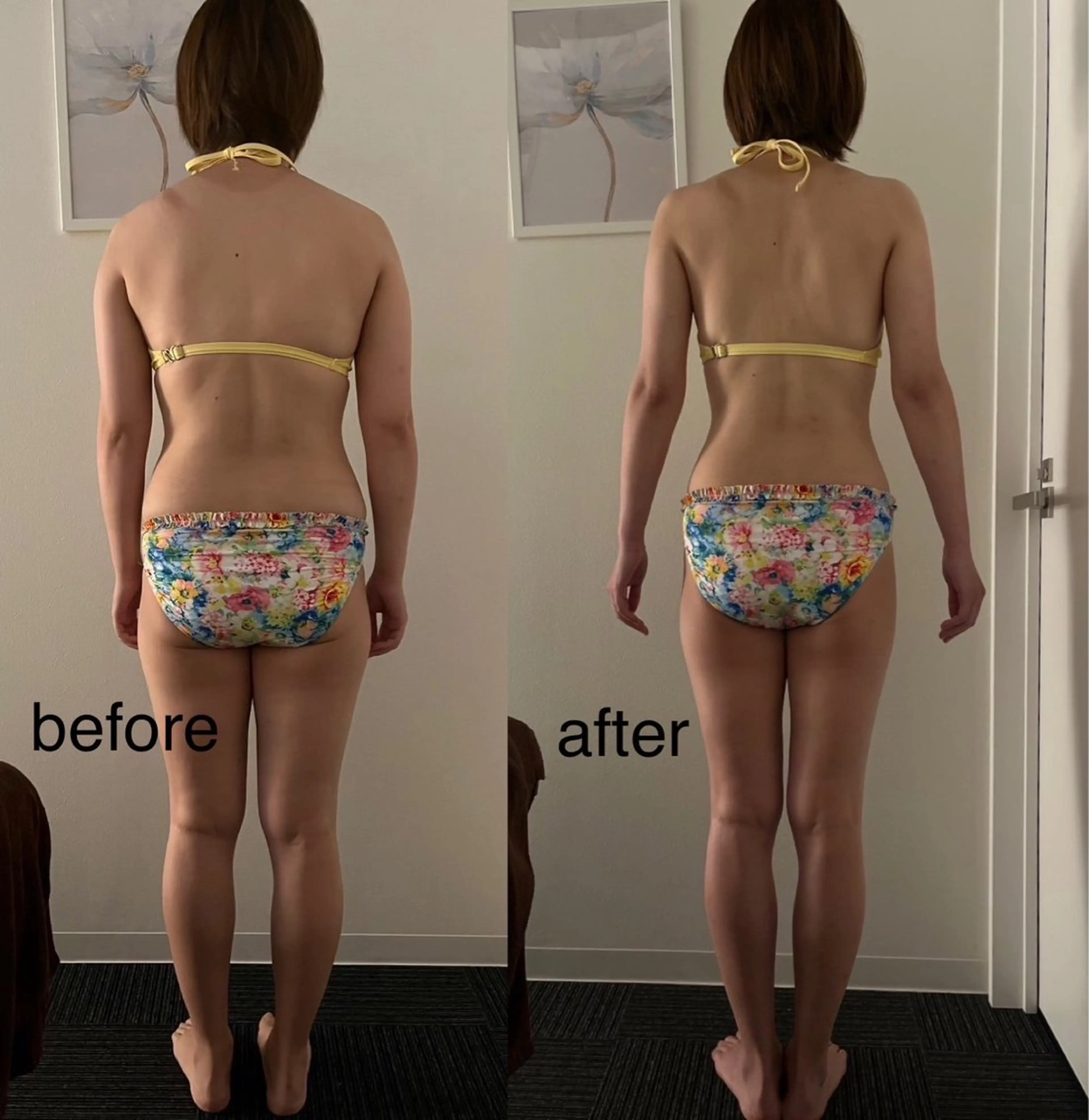 贅沢100分✨全身痩せ＋気になる部位を2つ選べる！オーダーメイド痩身コースの写真