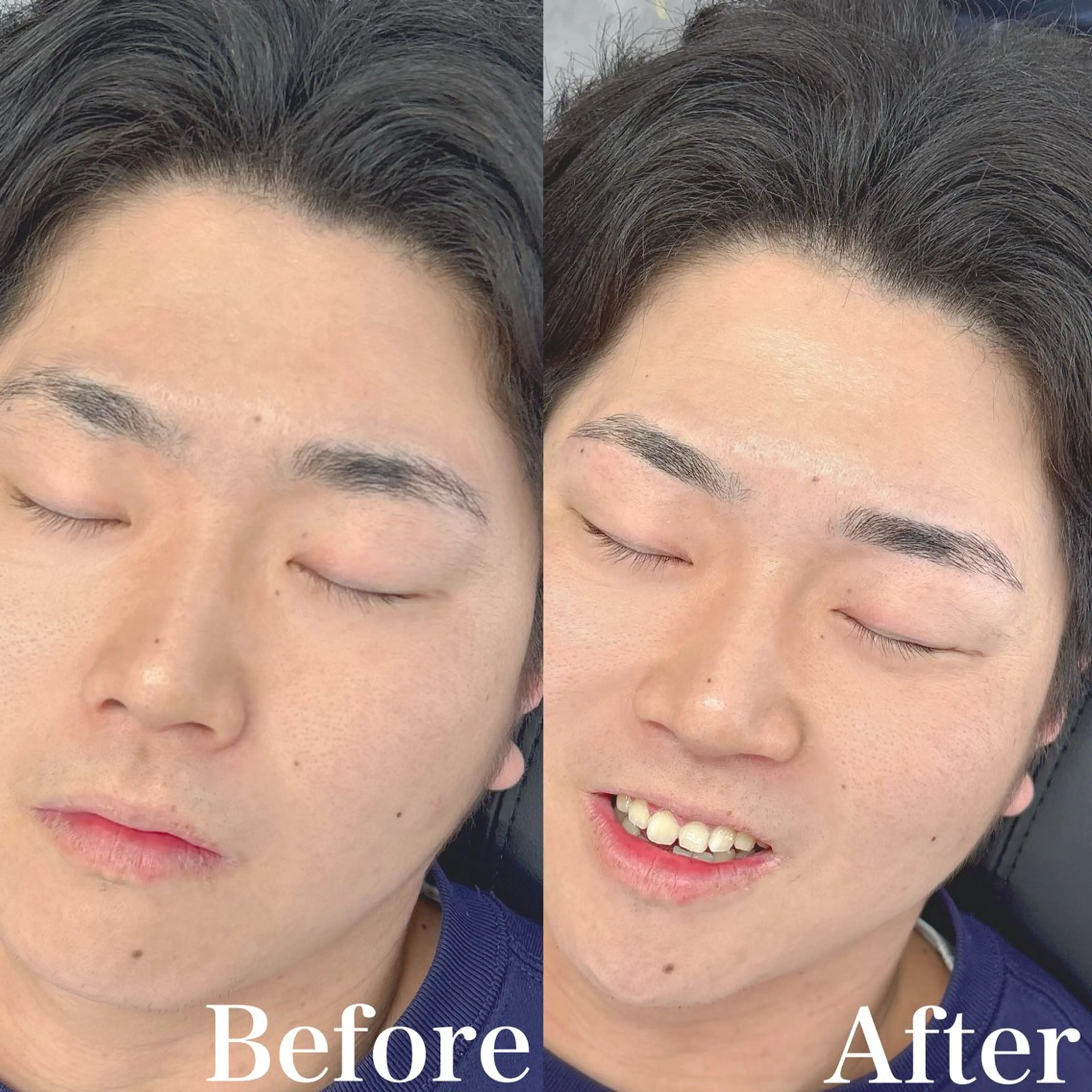 メンズ アイブロウ ワックス脱毛 眉カット 5日空きあり Yusukeの眉毛・アイブロウイメージ