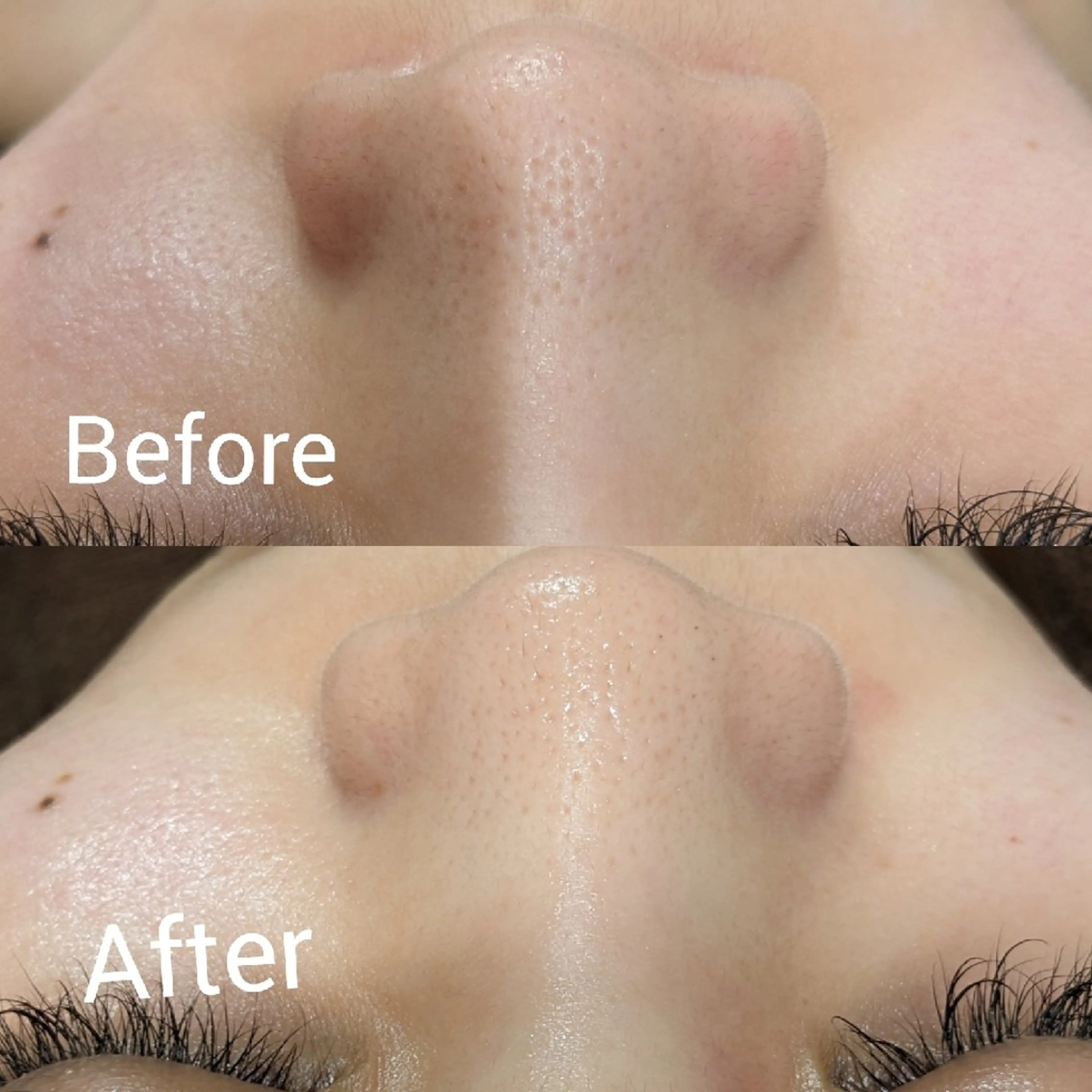 ﾌｪｲｼｬﾙｴｽﾃ ﾗﾄｩｰﾙ伊深のエステ・リラクイメージ