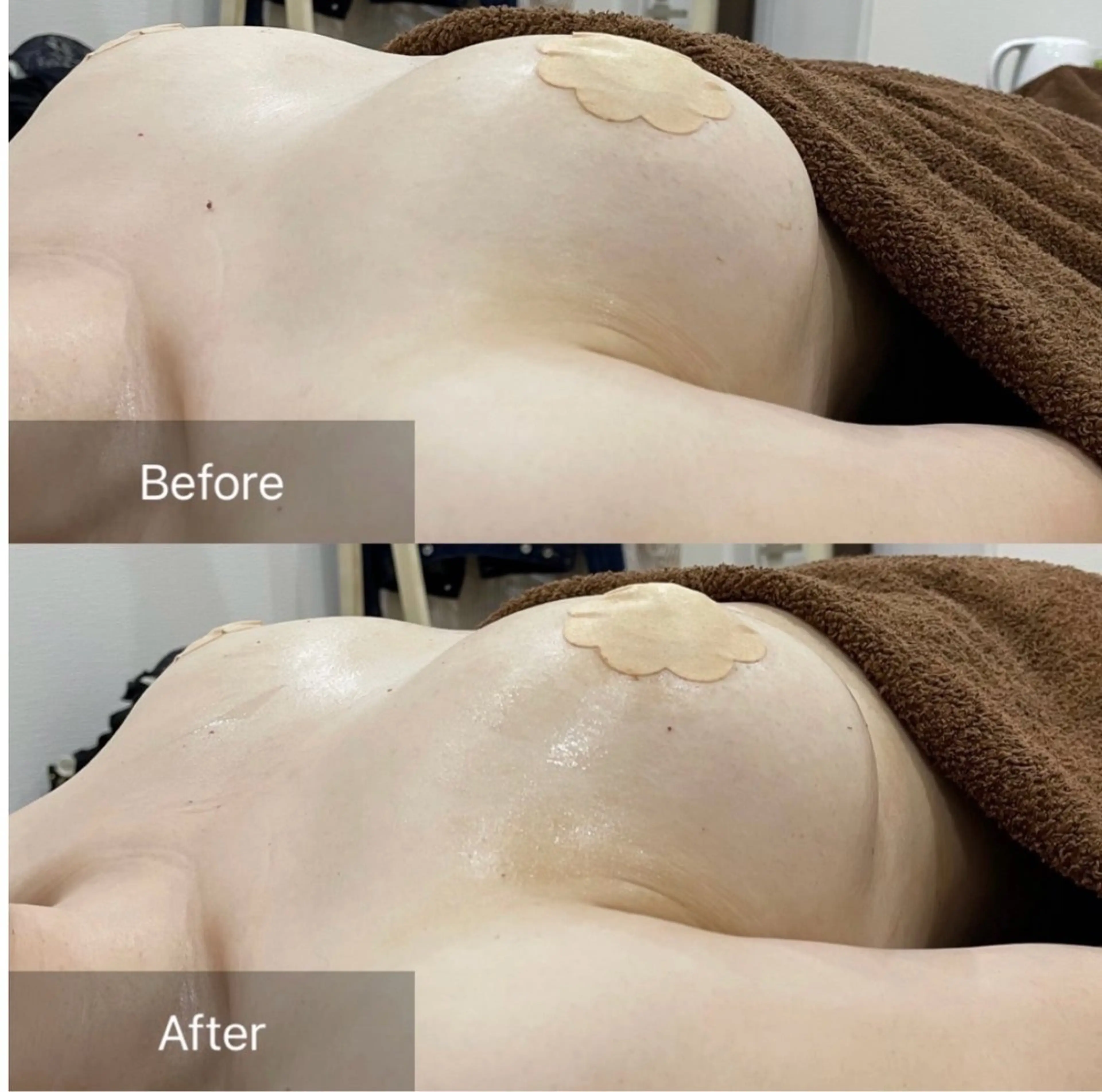 【最新NR機器を使用！】結果重視❣️ぷるふわバストアップケア❣️（上半身）の写真