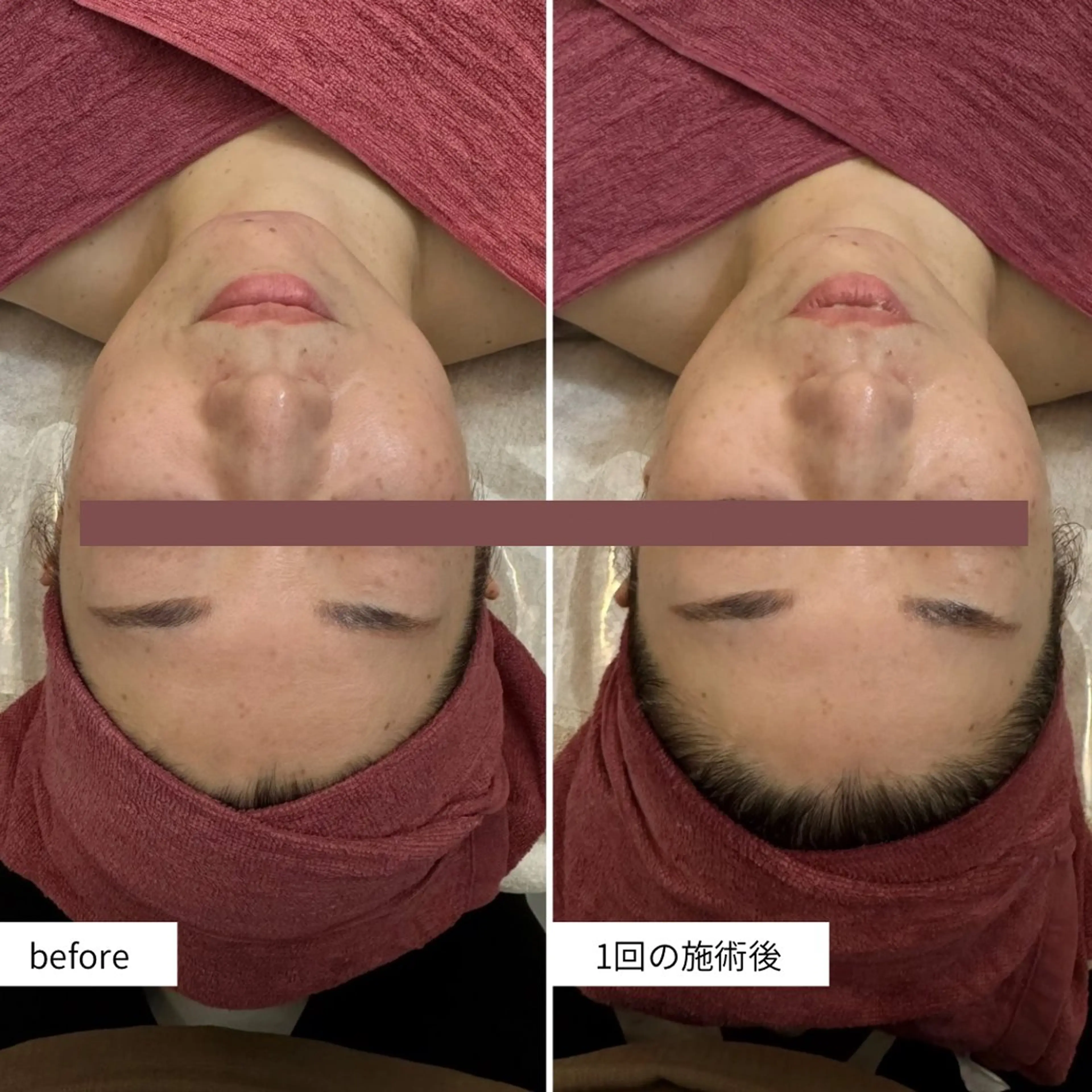 シミ・毛穴ケア専門 クロヌYUKIのエステ・リラクイメージ