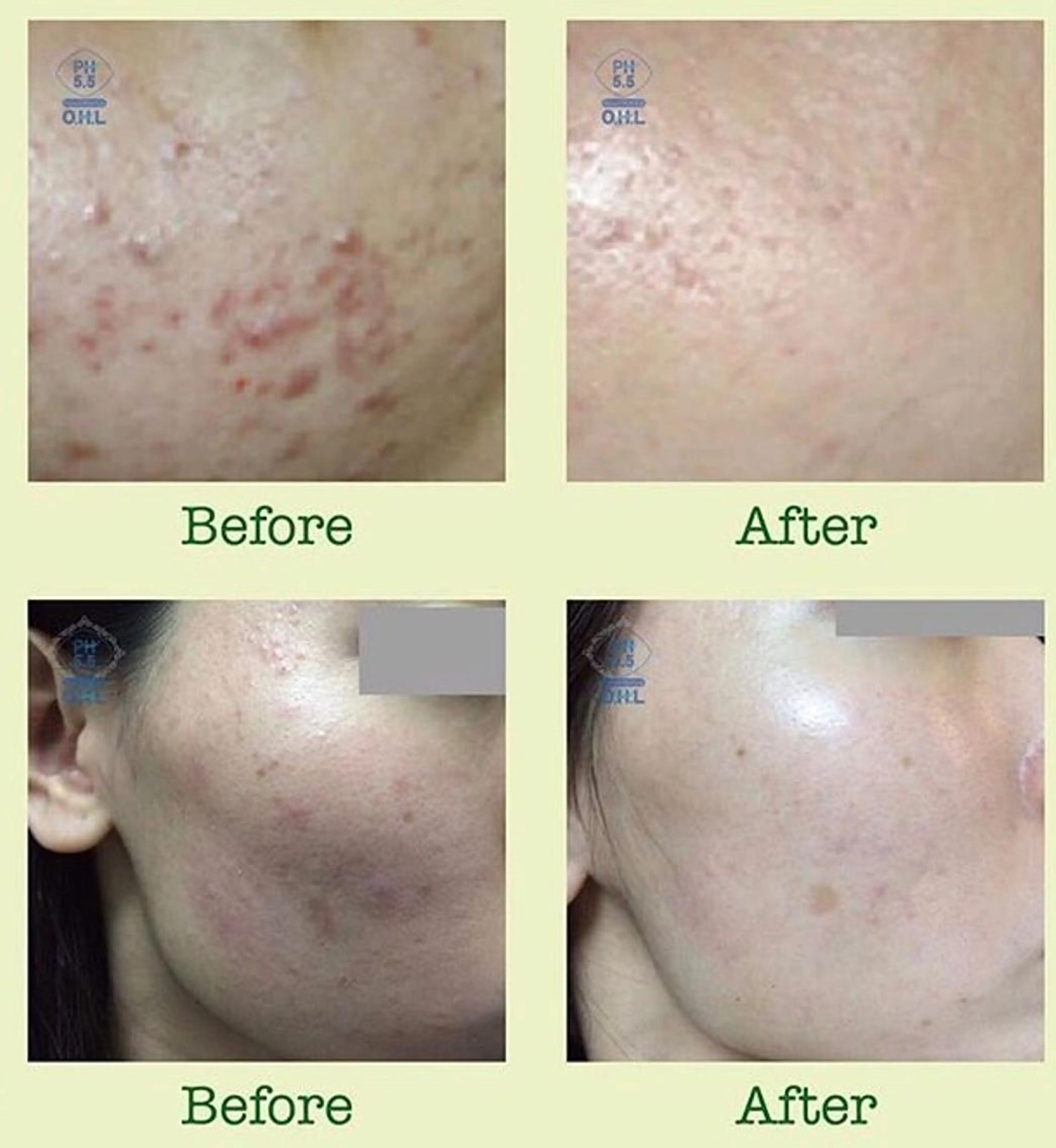 脱毛＆肌質改善サロン shandeelのエステ・リラクイメージ