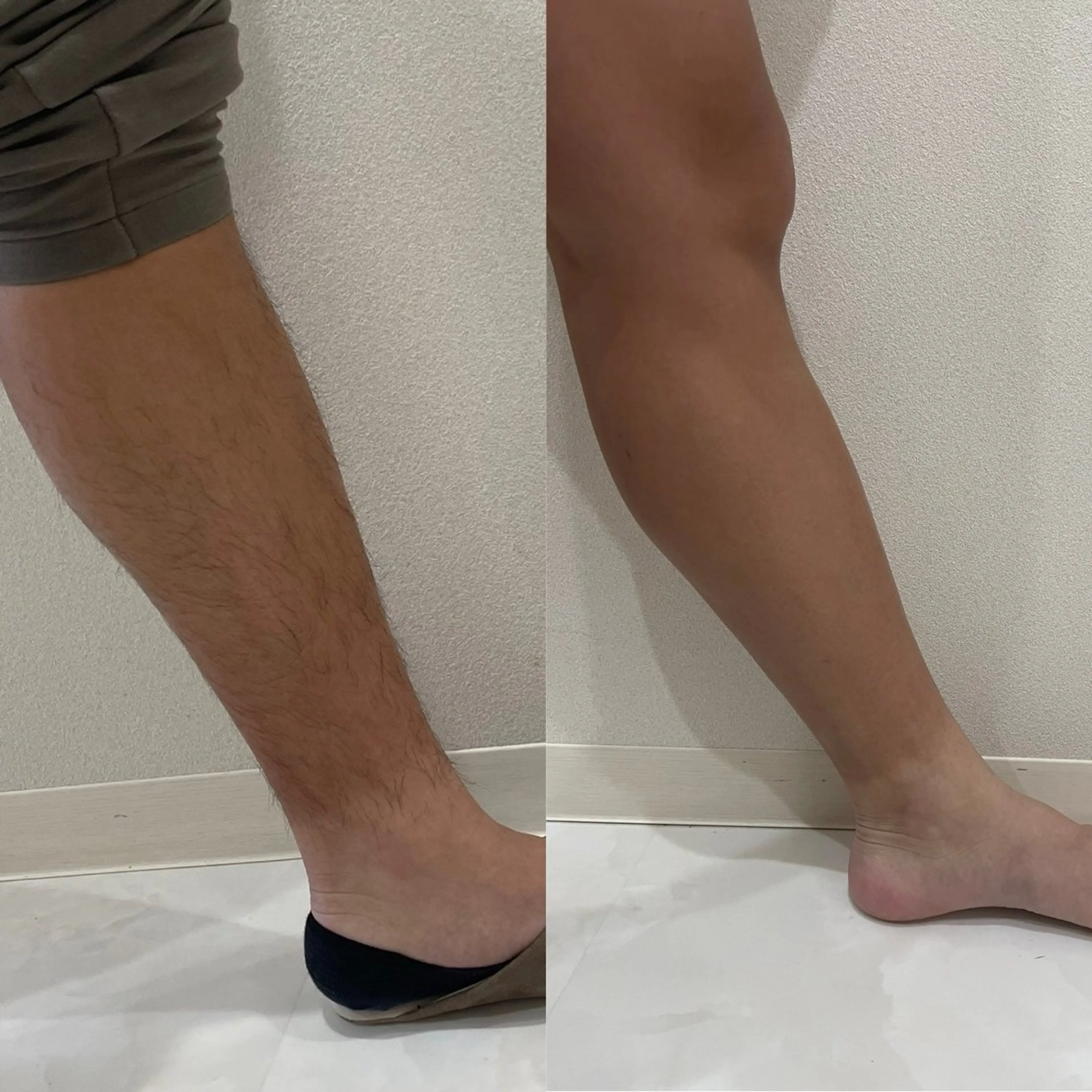 脱毛 Re:s SHIHOのエステ・リラクイメージ