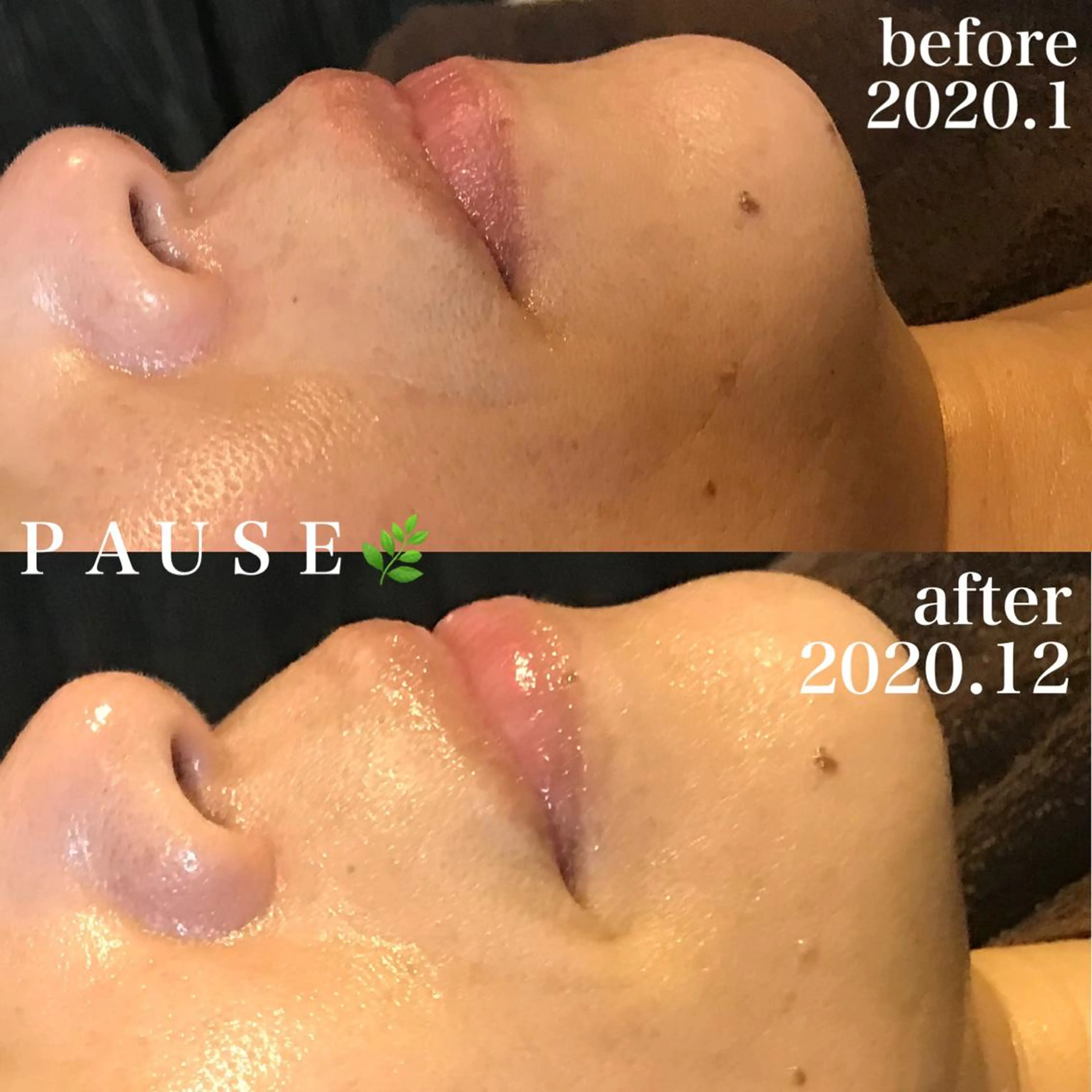 エステ 浜野 恵美のエステ・リラクイメージ