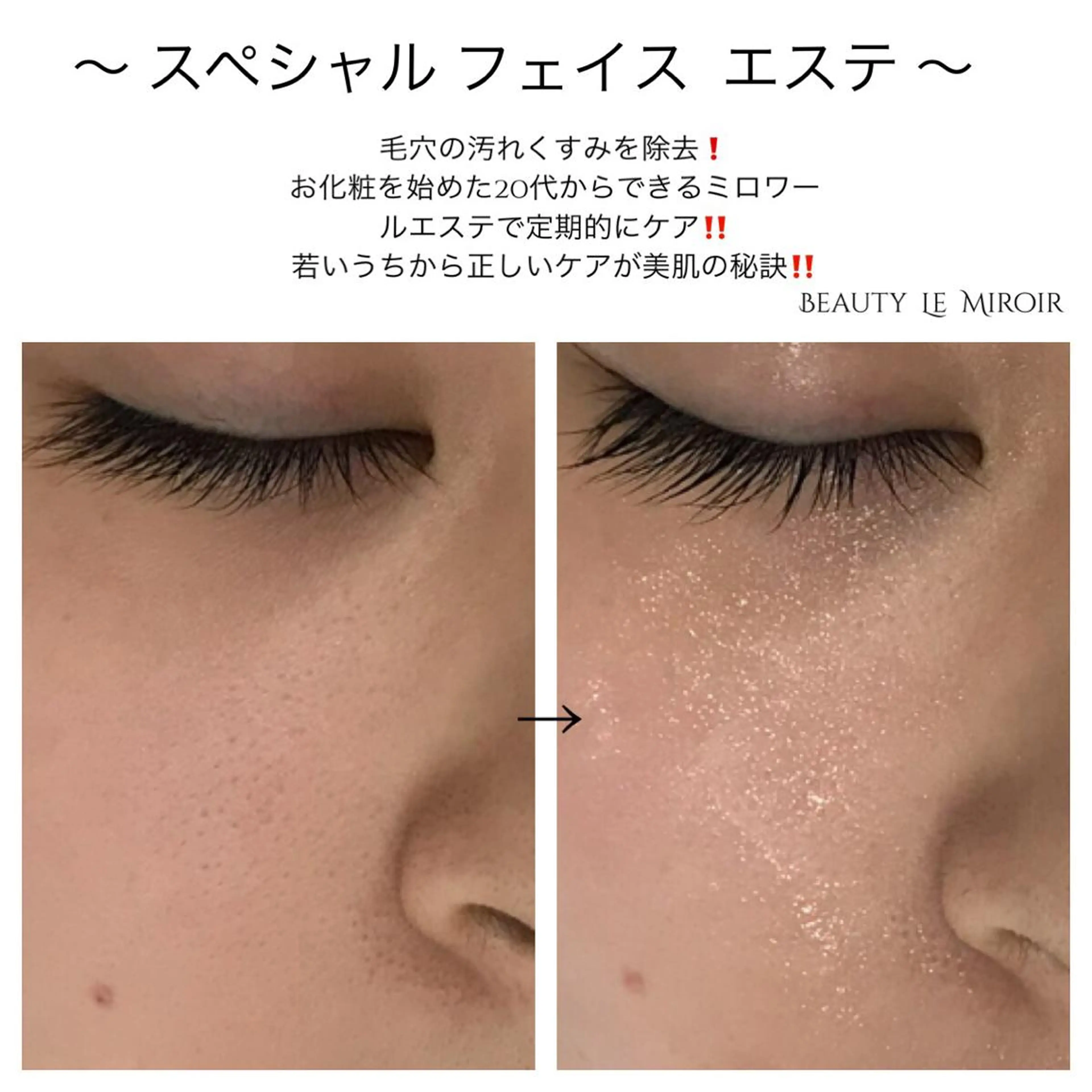 ビューティー ミロワールのエステ・リラクイメージ