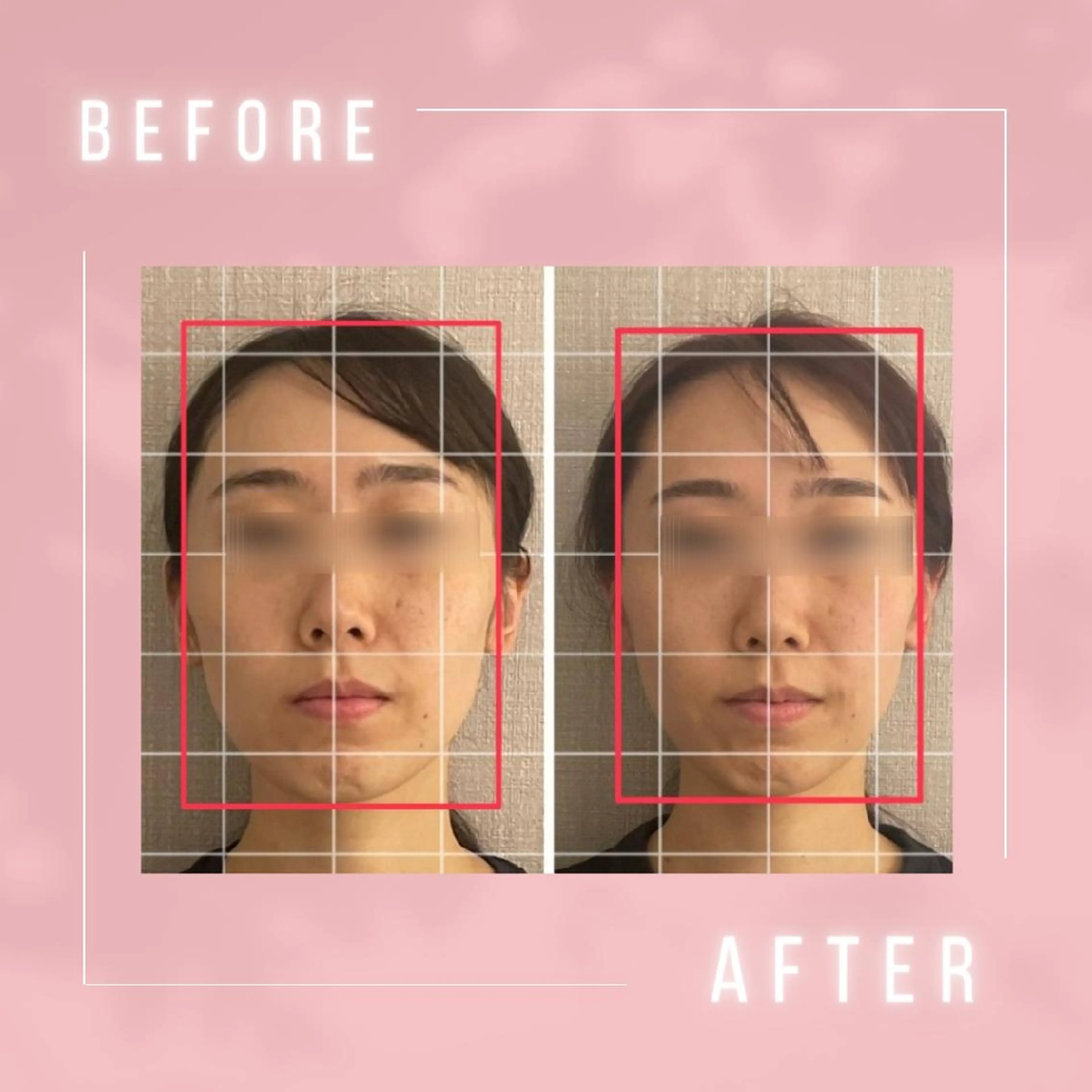 エステ リラク 小顔・肌悩み専門店 ボーテドリッシュのエステ・リラクイメージ