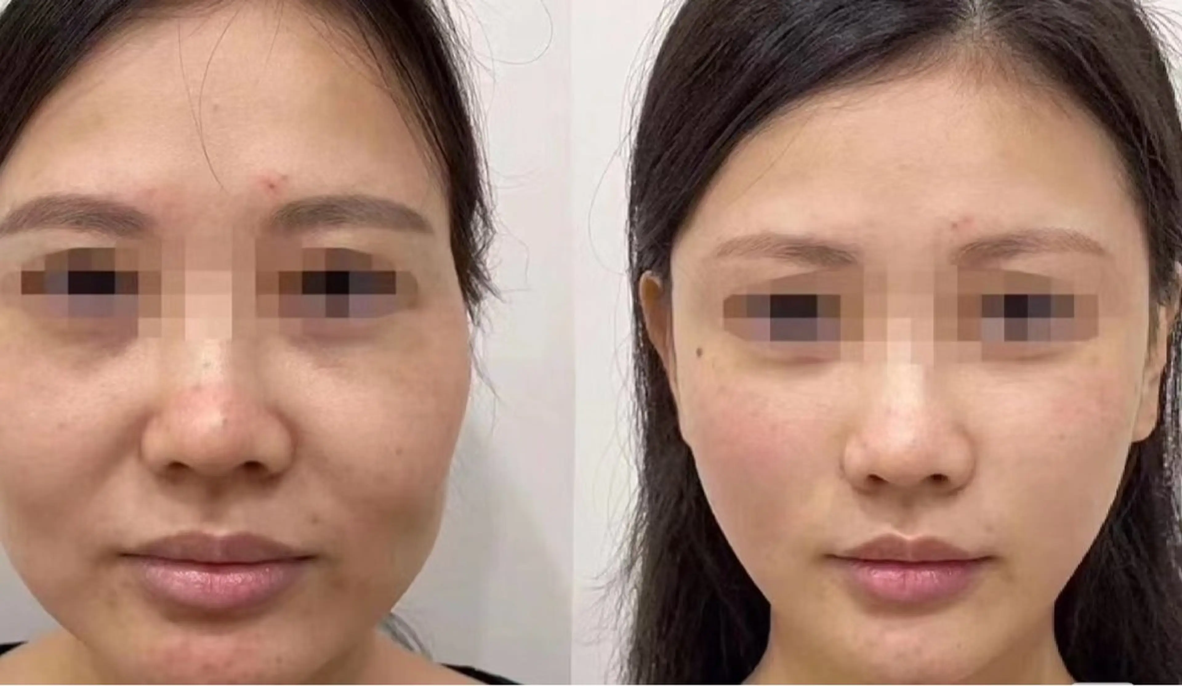 ネイル エステ aliaハーブ水光店 エステティシャン募集のエステ・リラクイメージ