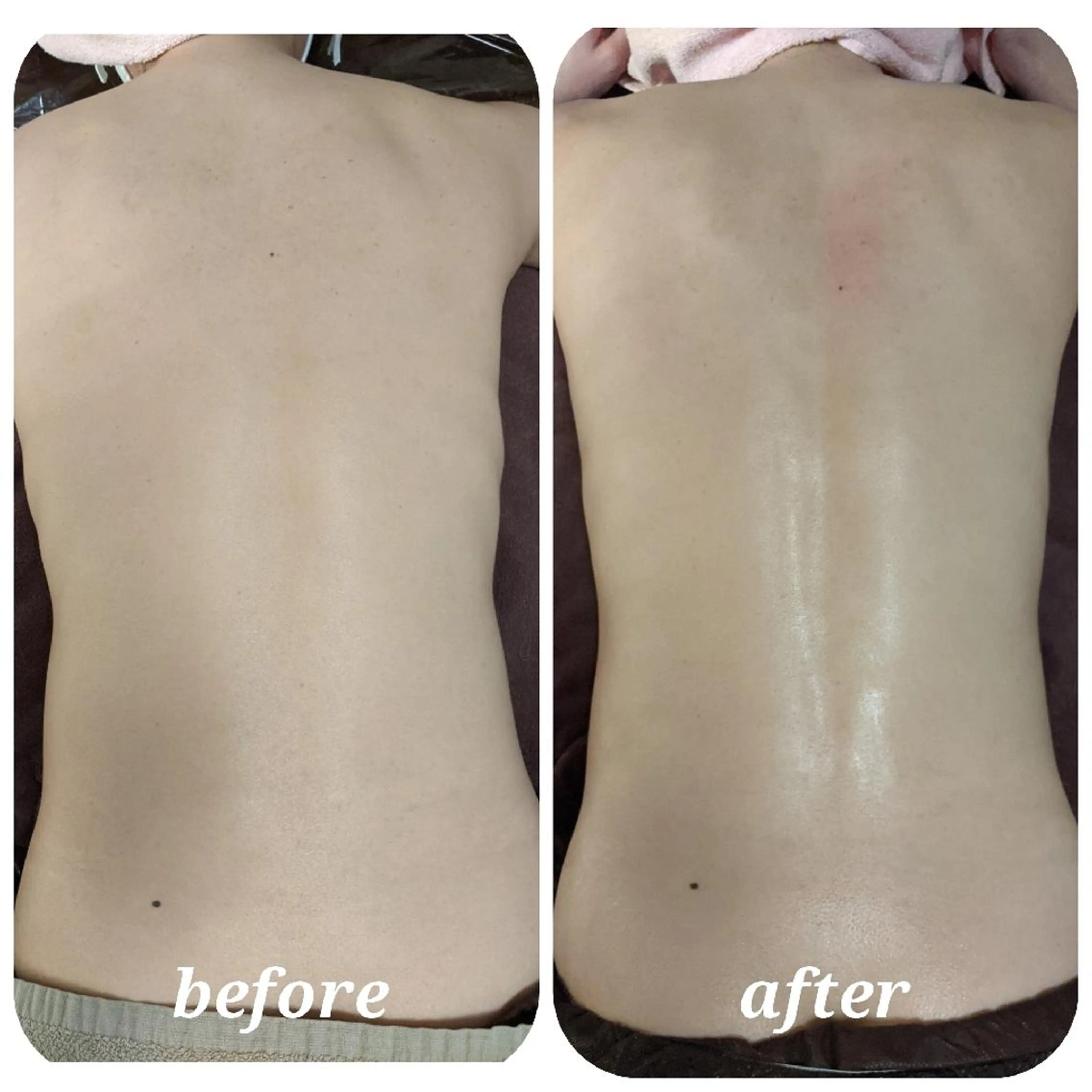 深層リンパオイル/小 顔とドライヘッドスパのエステ・リラクイメージ