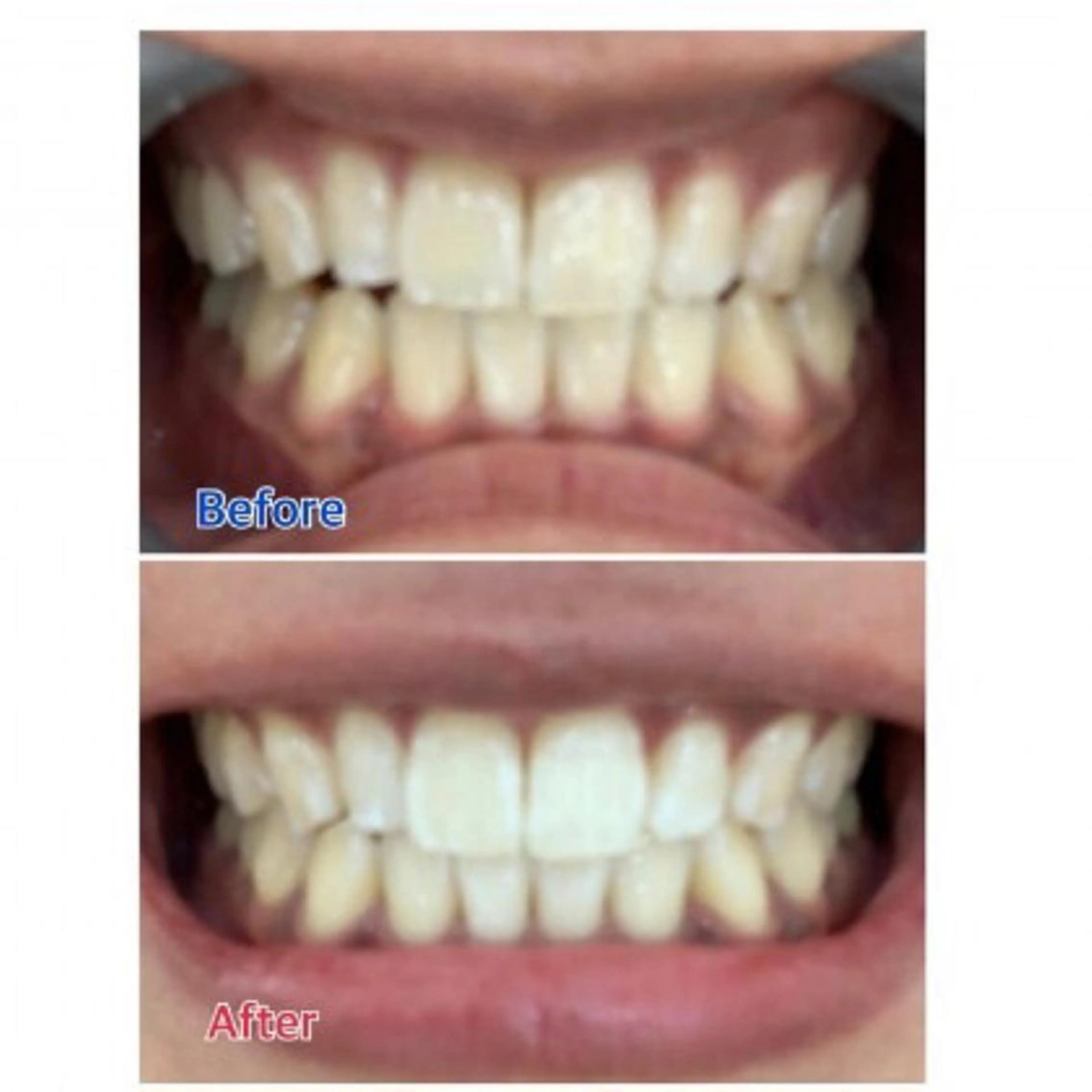 Ｍ渋谷 ホワイトニングのエステ・リラクイメージ