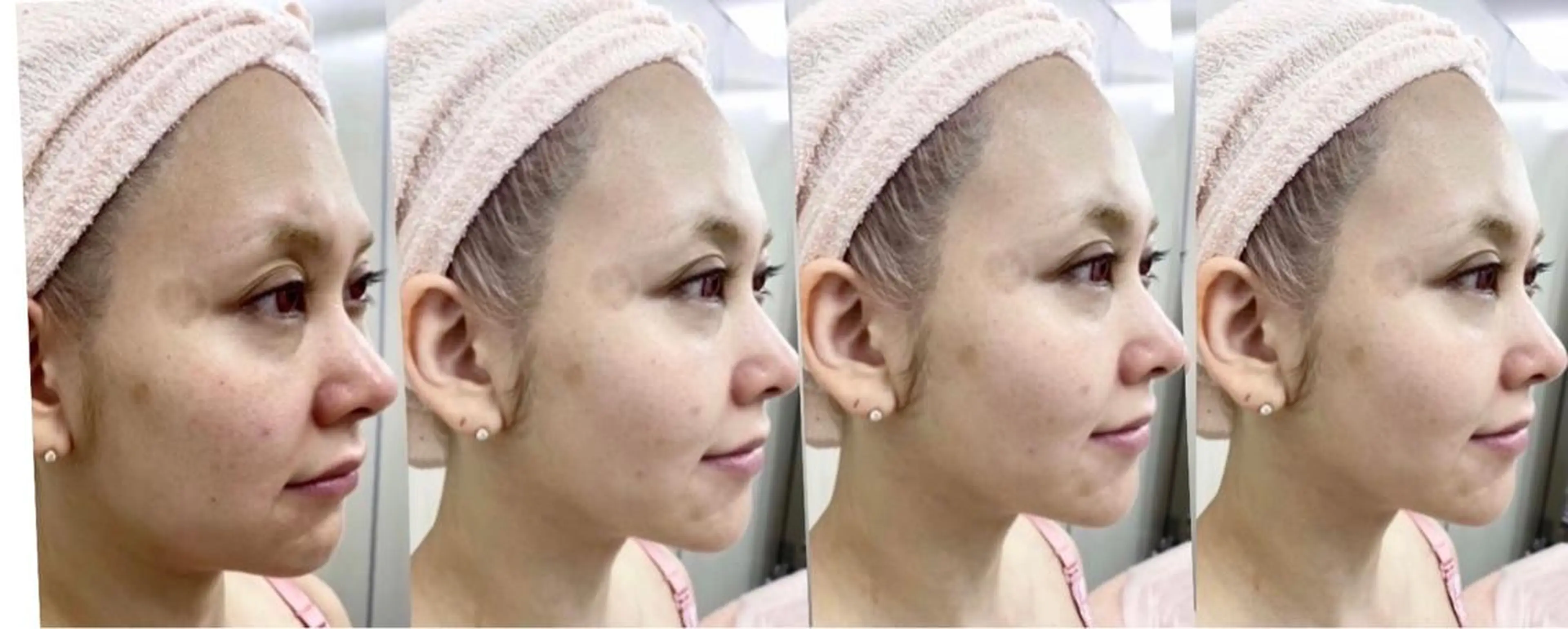 MARIRE EPISALONのエステ・リラクイメージ