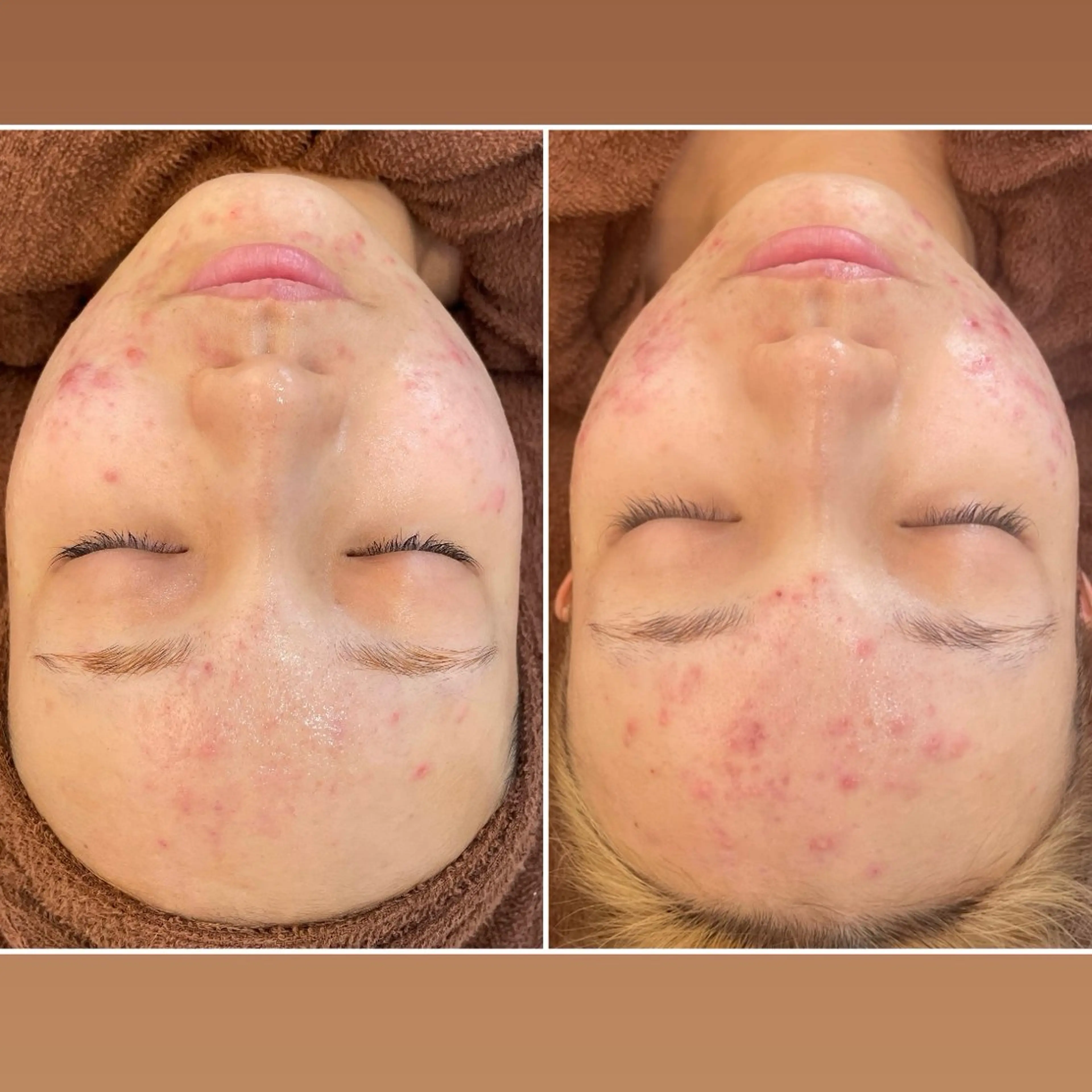 エステ リラク パーソナルスキンケア 🦋APRI🅿️有のエステ・リラクイメージ