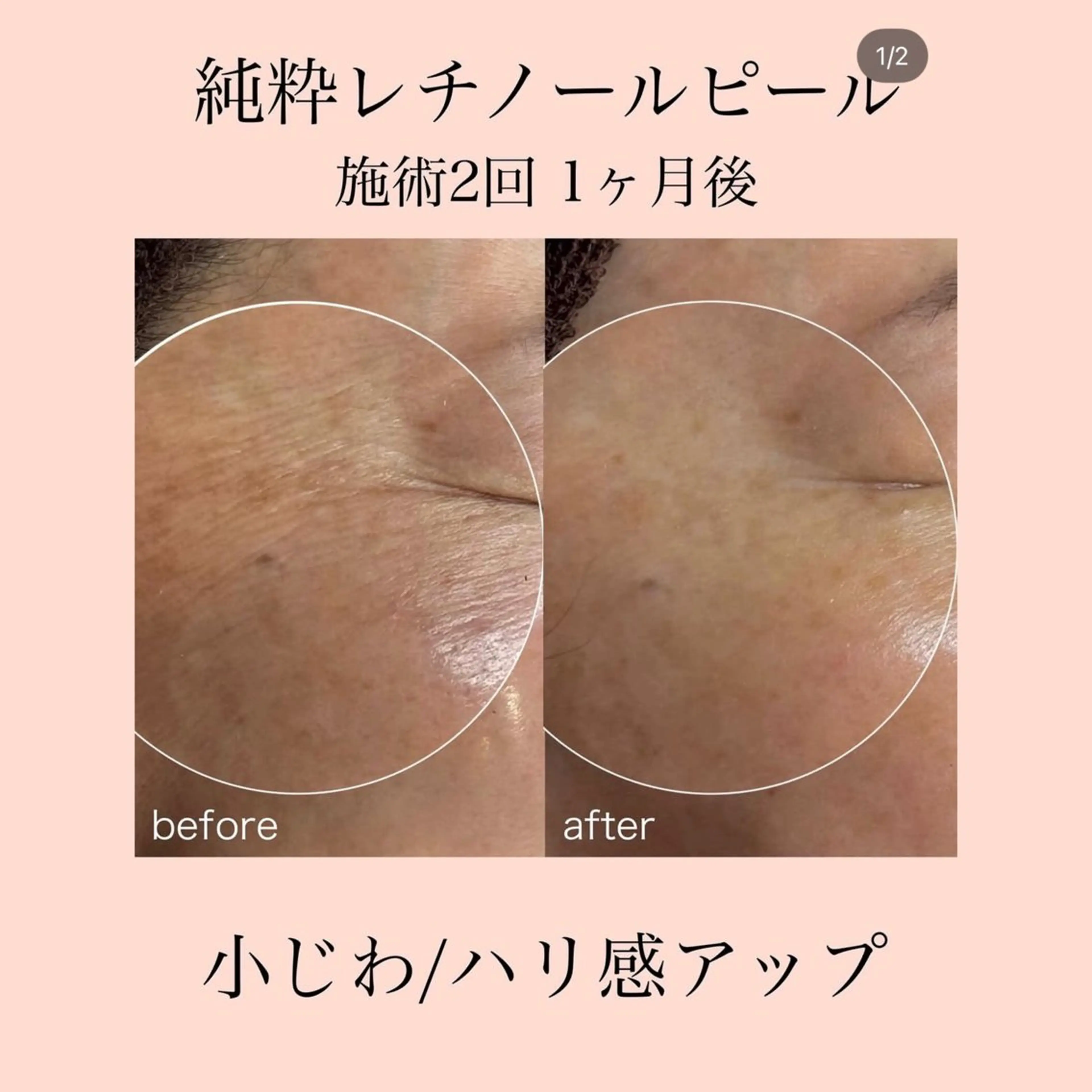 エステ Bell skin所属・肌質改善×癒しサロン Bell skinのエステ・リラクイメージ