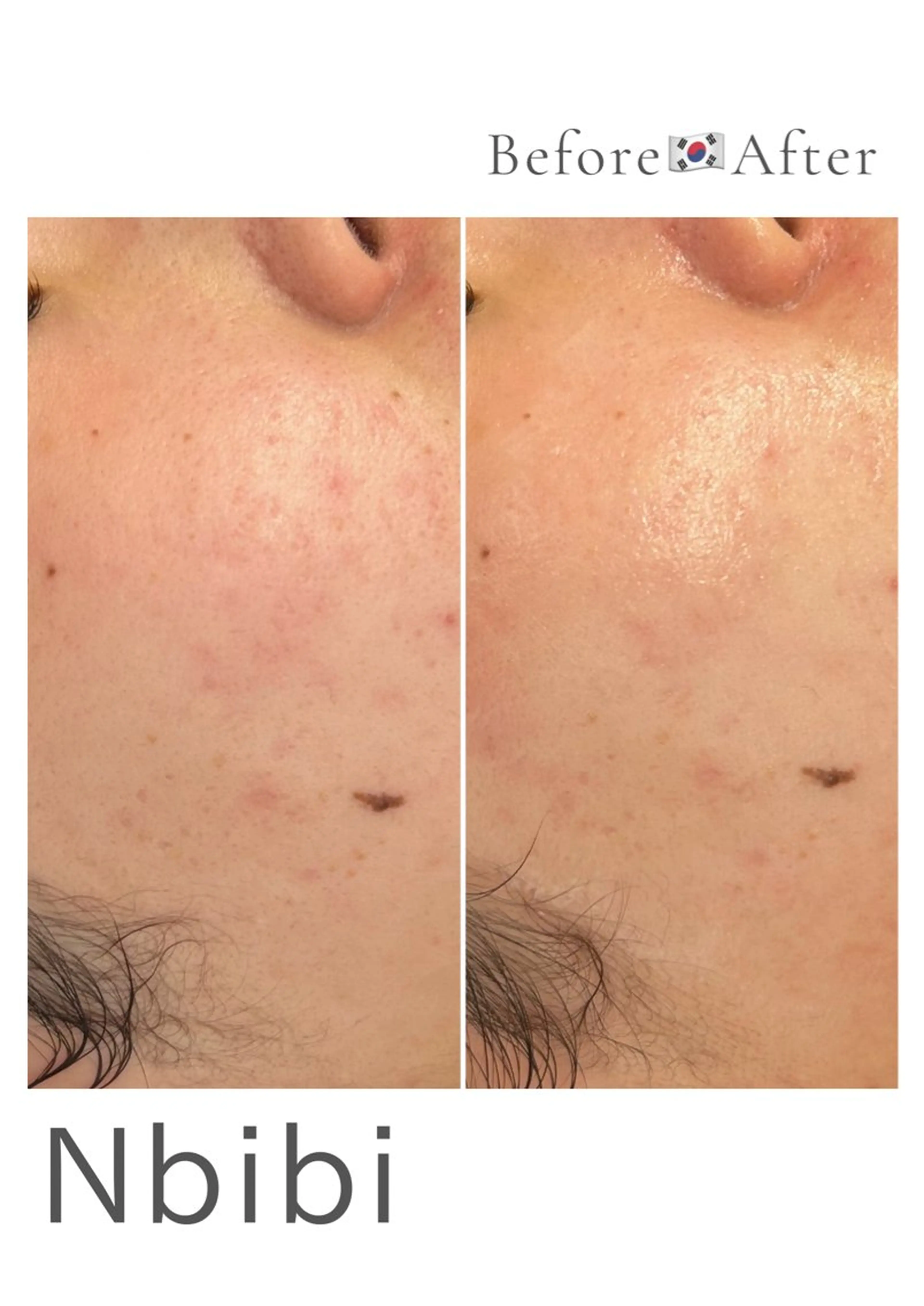 エステ 韓国🇰🇷価格 サロン_Nbibiの眉毛・アイブロウイメージ