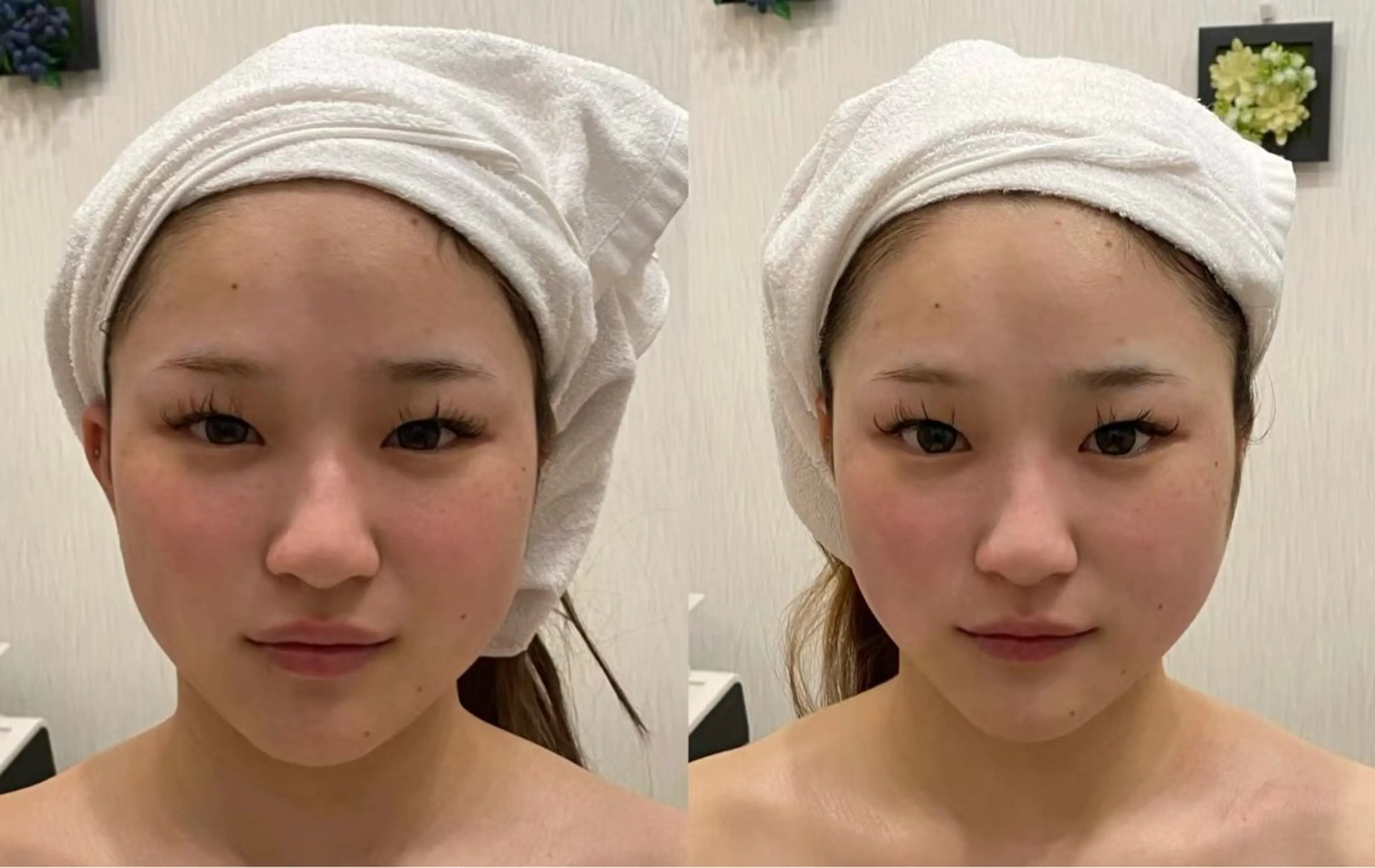 マツエク・マツパ エステ aliaハイフ&水光ジェットサロン所属・aliaハーブ水光店 エステティシャン募集のエステ・リラクイメージ