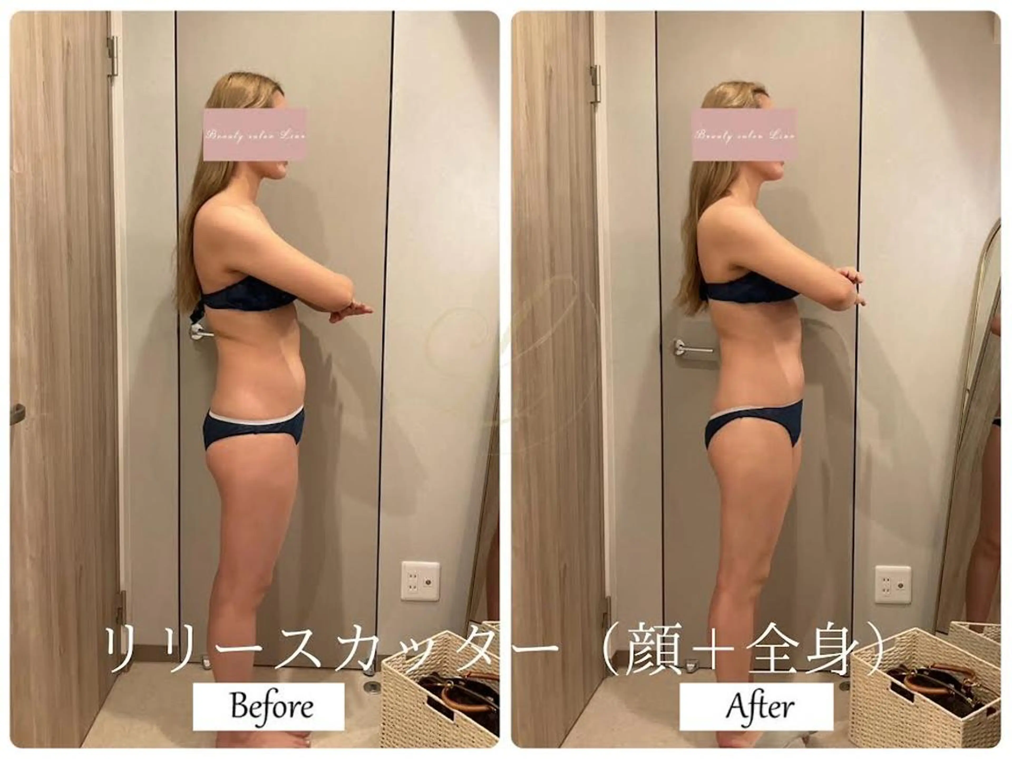 エステ リラク ブライダルサロン ｜Lino【堀江】のエステ・リラクイメージ